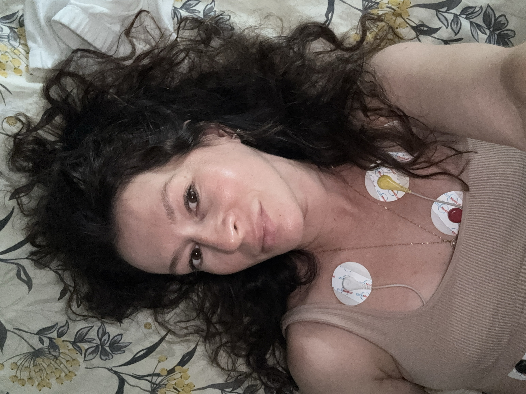 A woman is lying on her back on a floral-patterned bed. She has dark, curly hair spread around her head. She is wearing a beige tank top and has three medical monitoring leads attached to her chest. Two of the leads are circular with white and red colors, and one is yellow. She is looking up at the camera with a neutral expression. The background shows a bedsheet with a pattern of grey and yellow flowers. There is no indication of the city of Chaikovsky, Russia in the image.