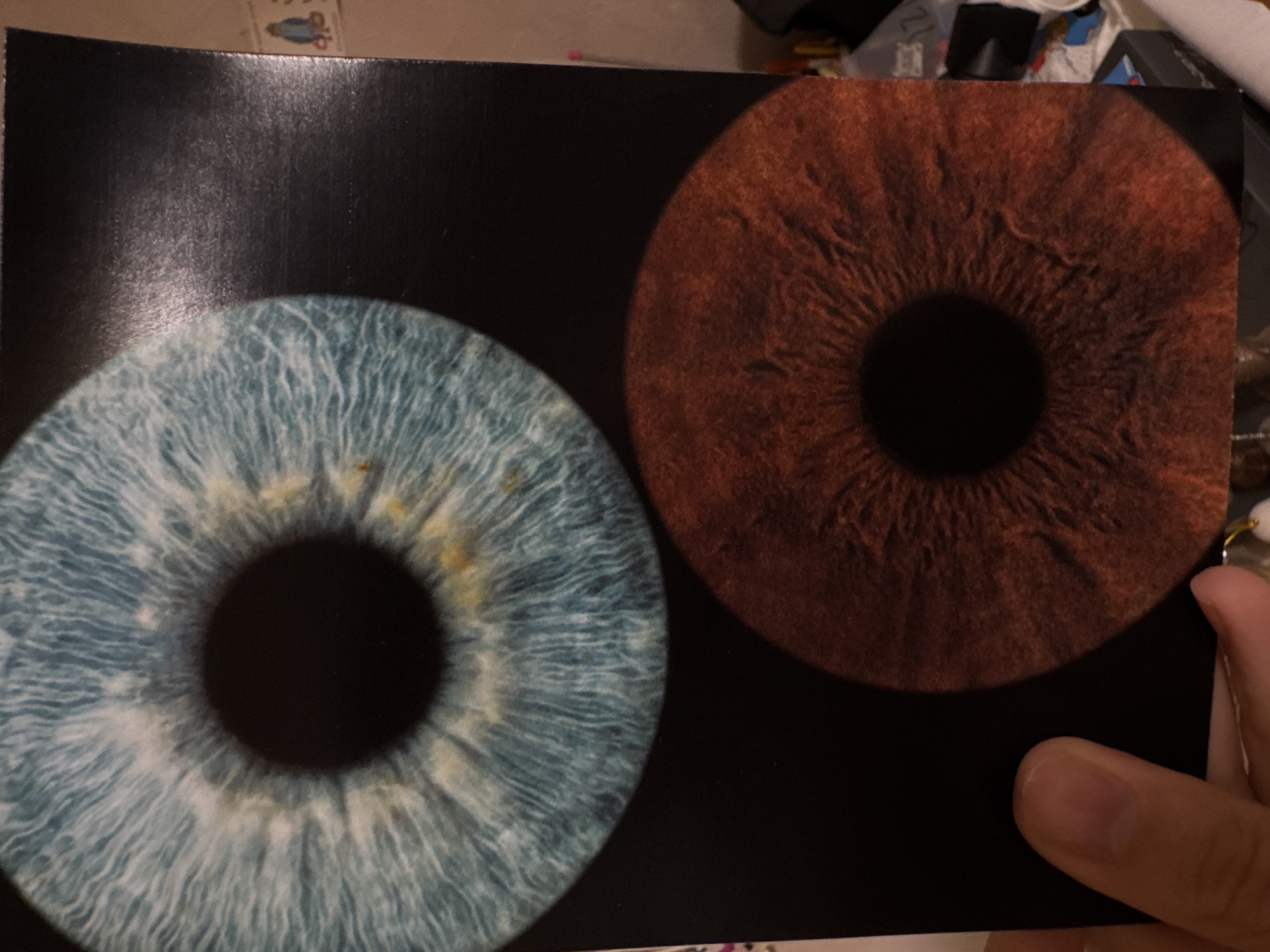 The image displays a close-up view of two irises, one above the other, set against a dark background. The top iris is a vibrant blue with fine, light-colored striations radiating outwards from a dark pupil. There are small, yellowish-brown speckles scattered across its surface. The bottom iris is a deep reddish-brown, also exhibiting intricate radiating patterns and a dark pupil. The overall impression is one of scientific or artistic representation of the human iris. The image is a photograph of a printed depiction of the irises. The bottom right of the image shows a hand holding the print. The background environment is indistinct, but hints of shelves with various objects and a wall can be observed. There is no visible connection to the city of Izhevsk, Russia.