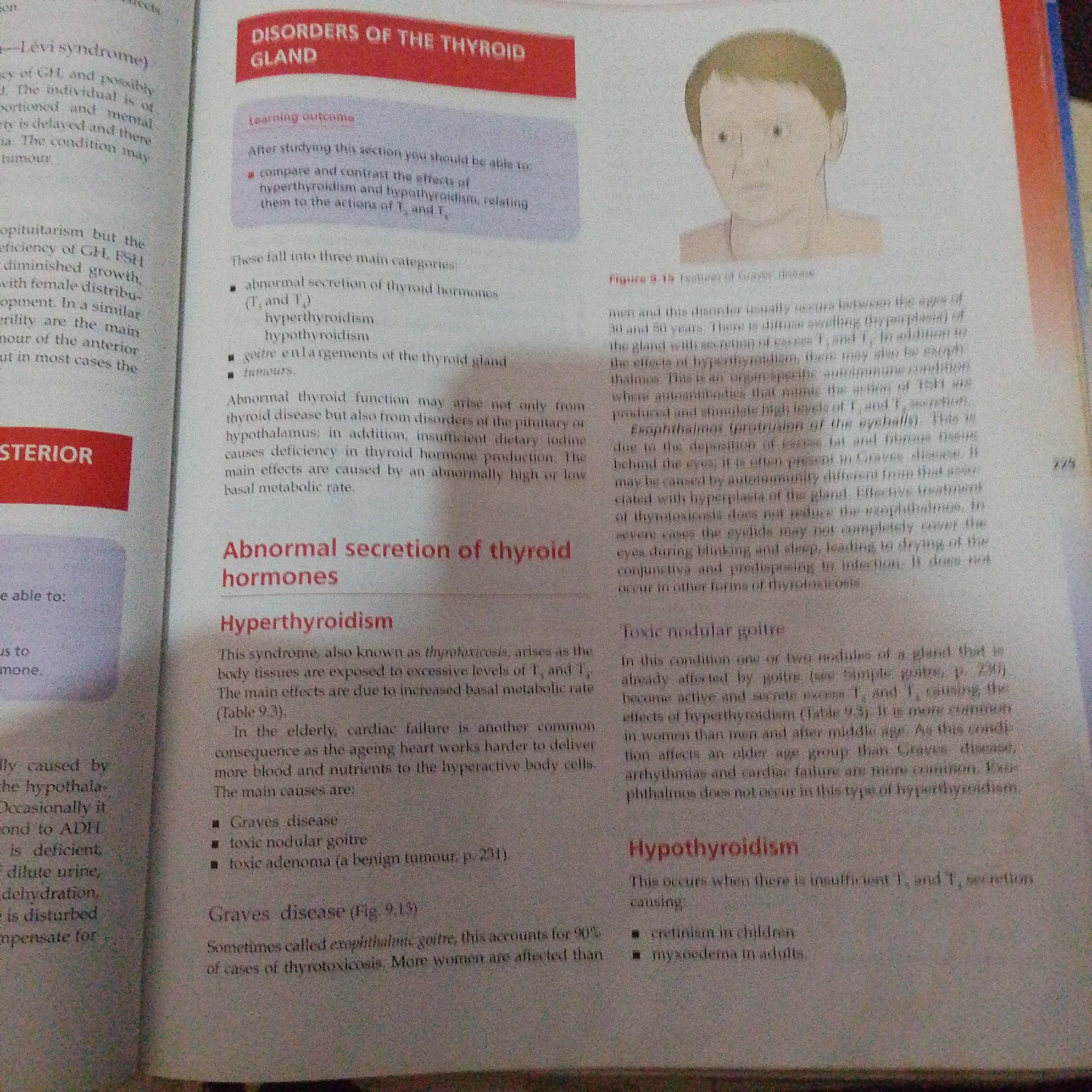 The image provided is a photograph of a page from a textbook discussing disorders of the thyroid gland. The page is divided into two columns. The left column contains a section titled "STERIOR" and some text related to pituitary disorders. The right column has a large red heading "DISORDERS OF THE THYROID GLAND" and a learning outcome. Below this, there is a list of categories of thyroid disorders, including "Abnormal secretion of thyroid hormones." Further down in the right column, there are sections on "Hyperthyroidism" and "Toxic nodular goitre." A small illustration of a human head is present in the upper right section of the page. The text appears to be printed in English. There is no information in the image that relates to Jalingo, Nigeria, or any specific city.