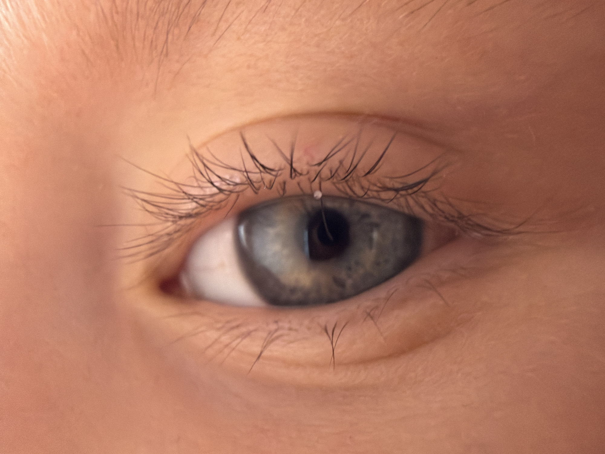 Close-up view of a human eye with light gray iris and black pupil, surrounded by light-colored eyelashes. The skin tone is fair, and some fine hair is visible above the eyebrow. No location information is provided in the image.