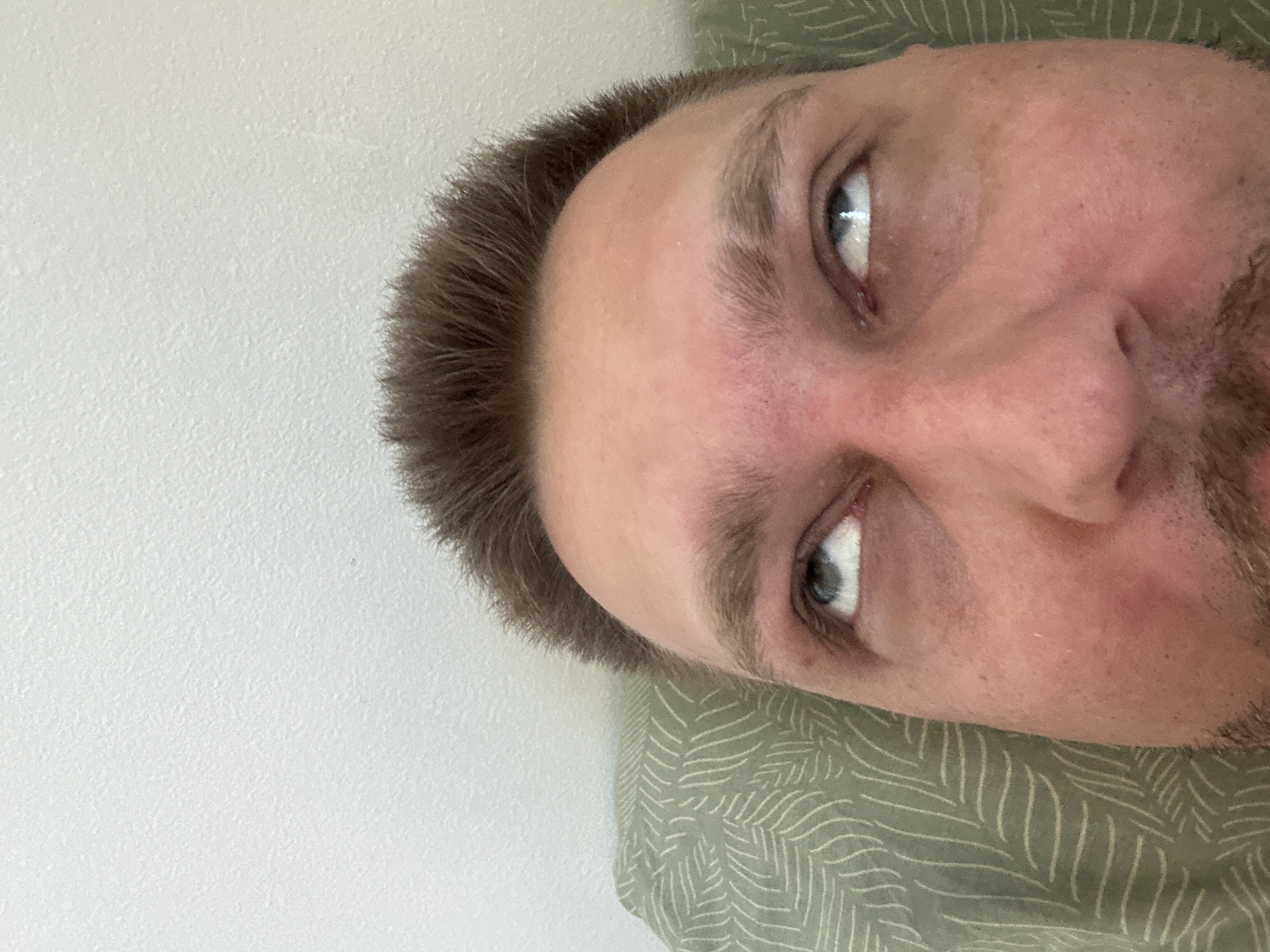 The image is a close-up, upward-facing selfie of a person's face, cropped to show their forehead, eyes, and part of their nose and chin. The person has light skin, brown hair styled upwards, and light-colored eyes that are rolled upwards, showing primarily the whites. Their eyebrows are light brown and somewhat thin. The person appears to be lying down, with the top of their head resting on a pillow that has a green leaf pattern. The background is a plain, textured white wall. The lighting suggests an indoor environment. No specific location in Zvezdara Urban Municipality, Serbia can be determined from the image.