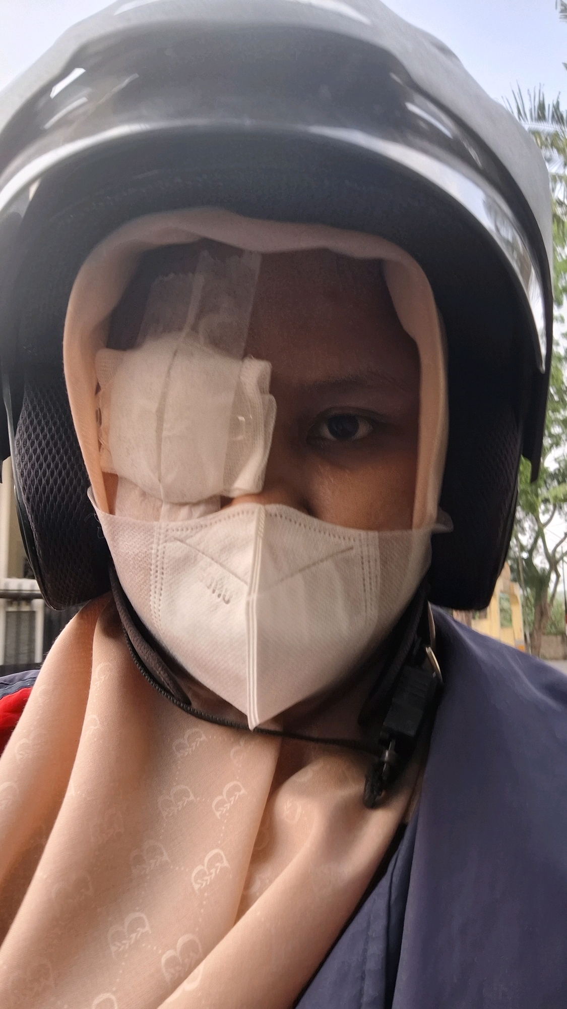 The image shows a close-up, selfie-style photograph of a person wearing a dark helmet and a light-colored headscarf. The person is also wearing a white medical mask covering their nose and mouth, and a white bandage is covering their left eye. Their right eye is visible and open. The person is wearing a dark blue jacket over a light peach-colored scarf with a subtle pattern. The background is blurred but suggests an outdoor environment with some greenery, possibly trees, and a light sky, consistent with a city location like Bandar Lampung, Indonesia. The focus is on the person's face, emphasizing the medical bandage.