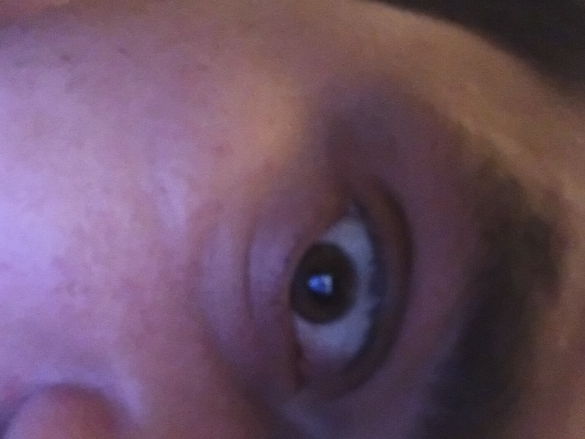 The image shows a close-up of a human eye, seemingly brown, with a reflected blue light source in the pupil. The surrounding skin of the face is visible, displaying pinkish and slightly mottled coloring. A dark eyebrow is partially visible above the eye. The angle suggests the photo was taken from a close and somewhat elevated perspective. There is no information available to suggest the location of Canterbury, United Kingdom in the image.