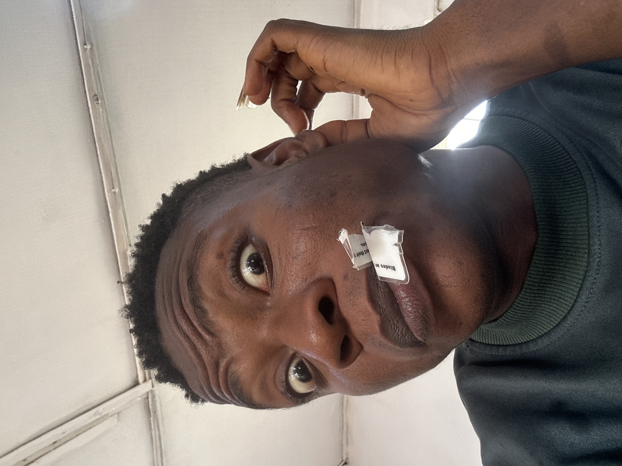 The image displays a close-up, upward-angled portrait of an individual situated in the city of Ikorodu, Nigeria. The person has a dark skin tone, short, tightly curled dark hair visible at the top of the forehead, and pronounced horizontal furrows across the brow, indicative of a raised eyebrow expression. Both eyes are wide open, revealing a significant portion of the sclera around the irises, and the pupils appear dilated. The mouth is slightly agape, with dark-toned lips. A torn white label or piece of paper is affixed to the lower left side of the face, near the corner of the mouth; partial text visible on the label includes "Blades an" and "act their r". The individual is wearing a dark green long-sleeved shirt with a ribbed crew neck collar. The left hand is raised, with the thumb and index finger positioned near the earlobe. The fingernails on the thumb and index finger are noticeably long and light in color. The background is a plain, light-colored surface, possibly a ceiling or upper wall, featuring a horizontal structural beam with multiple small fasteners and minor discoloration. A bright light source is present in the upper right background, creating a slight glare.