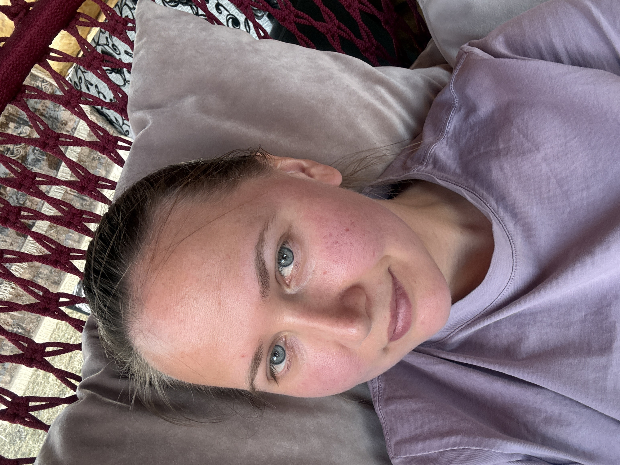 An adult female is depicted in a close-up, top-down shot, resting horizontally with her head on a light gray pillow. She has fair skin, light blue eyes, and light brown hair pulled back from her face. Her cheeks and forehead exhibit redness. She is wearing a light purple, crew-neck t-shirt. Behind her head and the pillow, a structure of dark red woven cords is visible, suggesting a hammock or similar suspended seating. Blurred patterns in shades of beige and dark gray are discernible in the background, beyond the woven structure. The scene takes place in Tyulyuk, Russia.
