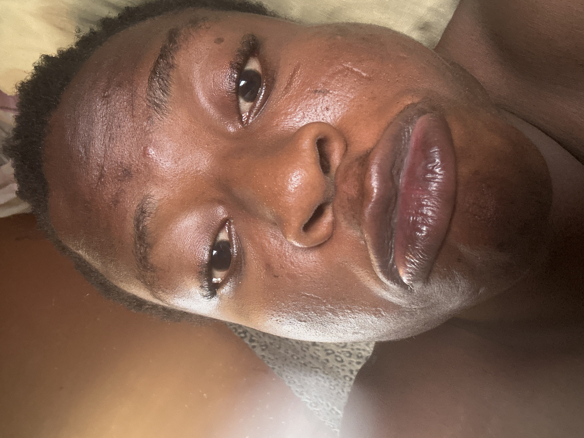A close-up, angled view shows a Black person with dark skin and short, dark hair. Their face is facing up towards the camera. The person's eyes are open, and their lips are slightly parted, appearing glossy. There are a few small marks or blemishes on the forehead and cheek. The background is blurred and consists of what appears to be fabric in light and dark tones. The location and city are unknown.