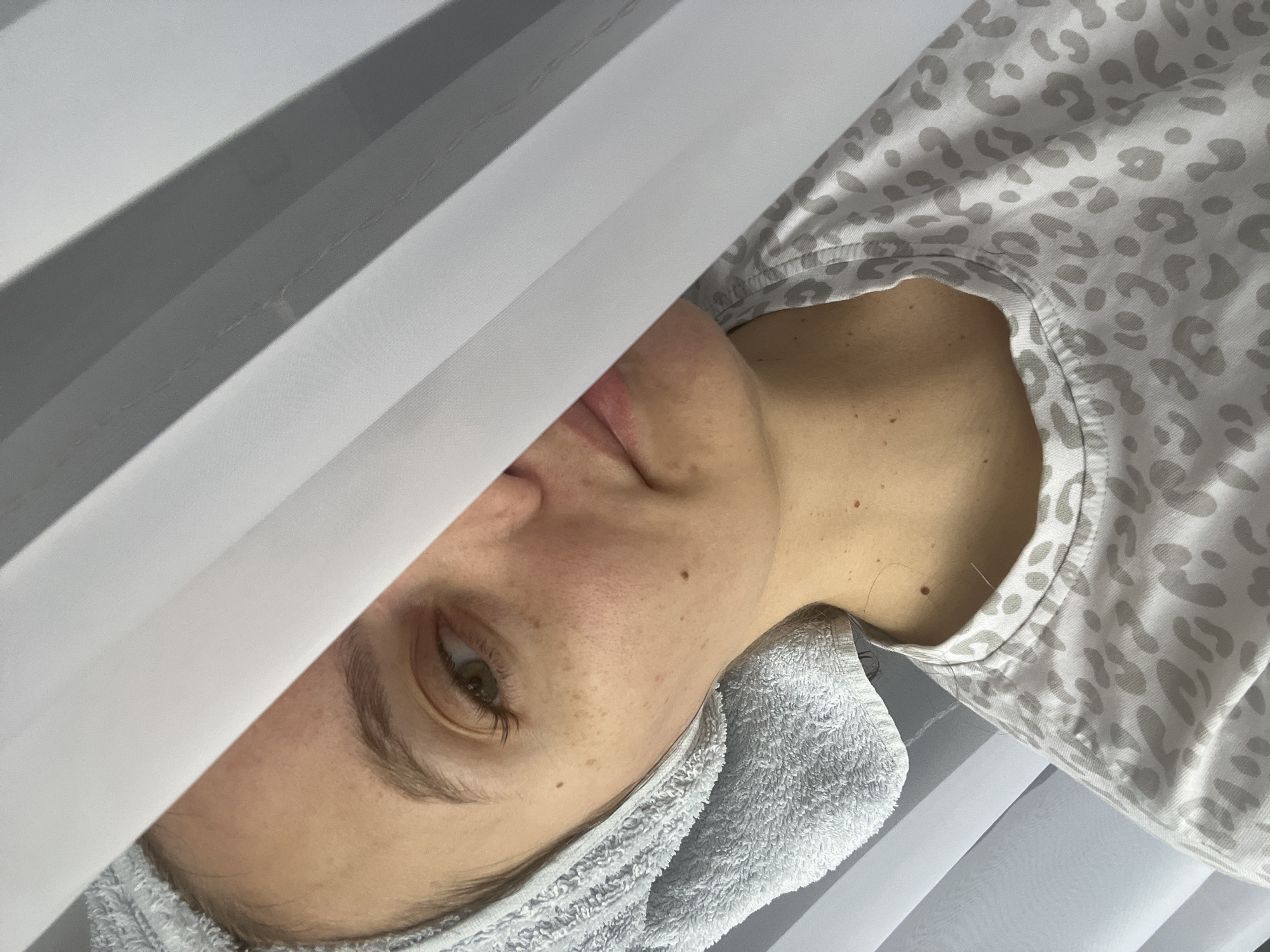 A close-up, tilted shot depicts a person's face partially obscured by a white object, possibly a curtain or sheet. The person appears to have a towel wrapped around their head. They have fair skin with freckles and a visible eye with an eyebrow. The person wears a light-colored, patterned shirt. White blinds are visible in the background. The photo's location is unknown and cannot be determined from the image. The city of Chaikovsky, Russia, cannot be verified from the image.