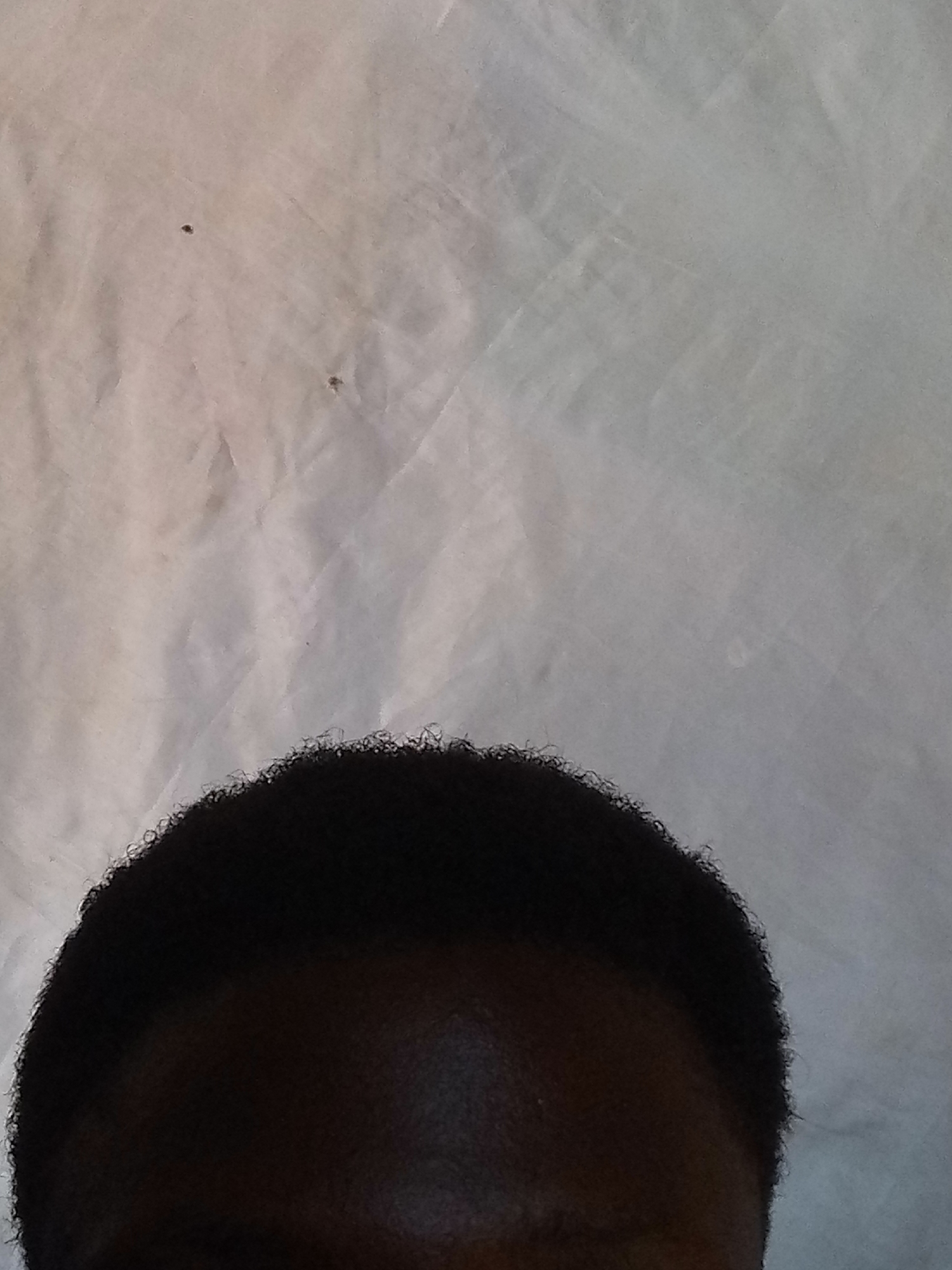 The image shows the top portion of a person's head, specifically their forehead and hair. The background is a textured, light-colored fabric, possibly a bedsheet or curtain, with some faint creases and shadows. There are two small, dark specks on the fabric in the upper left quadrant of the image. The person has dark, curly hair that frames the top of their head. No specific location in Nyabe, Nigeria, can be identified from this image.