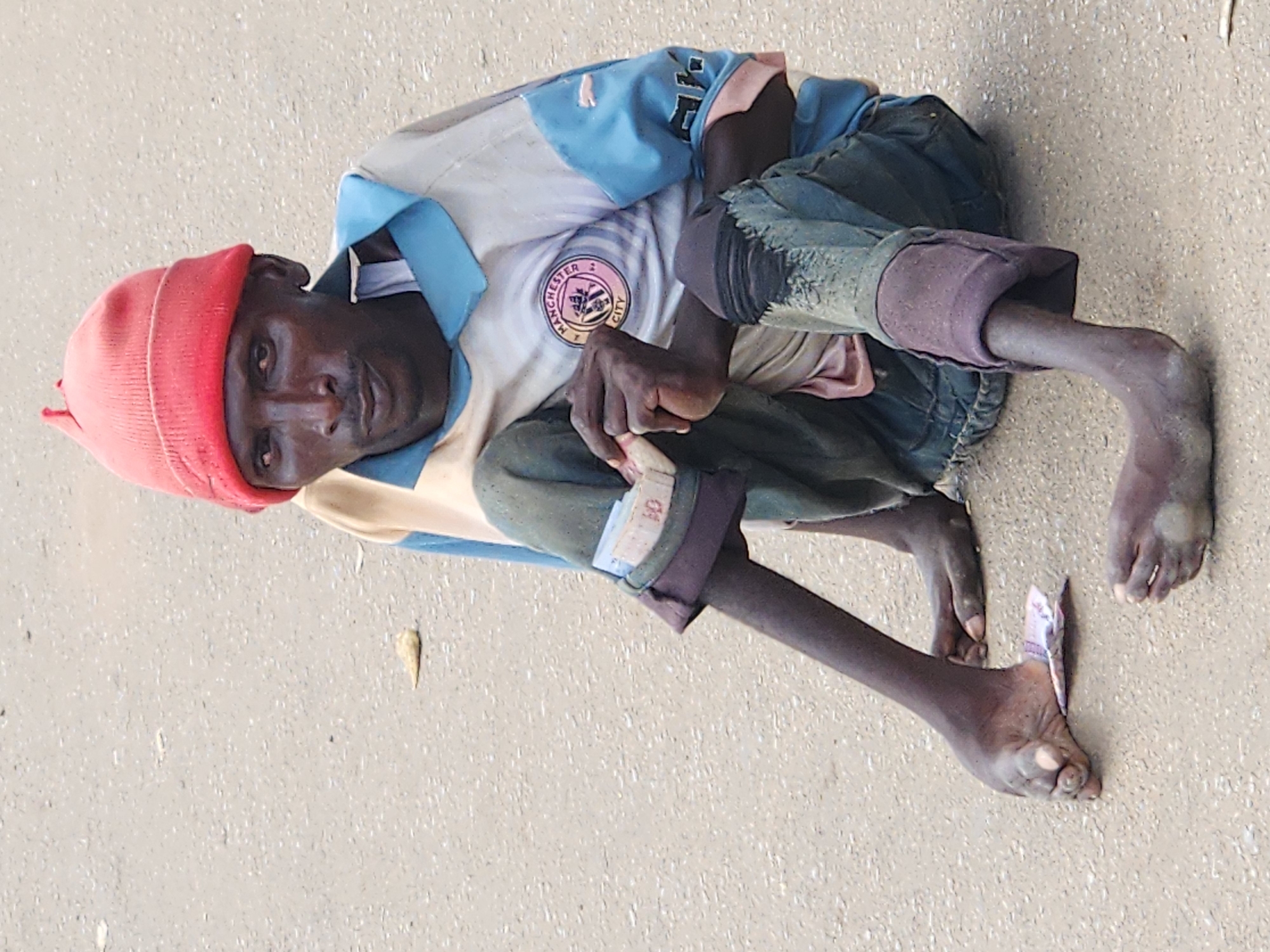 A man wearing a red beanie and a shirt with a Manchester City logo sits on a paved surface, likely a street in Jos, Nigeria. He is holding a small stack of banknotes in his right hand and has money placed under his left foot. His clothing appears worn, with his pants rolled up to reveal his legs and feet, which show signs of malnourishment. The background is a neutral paved surface with some debris. The image focuses on the man and his immediate surroundings, capturing a moment of apparent begging or financial struggle.