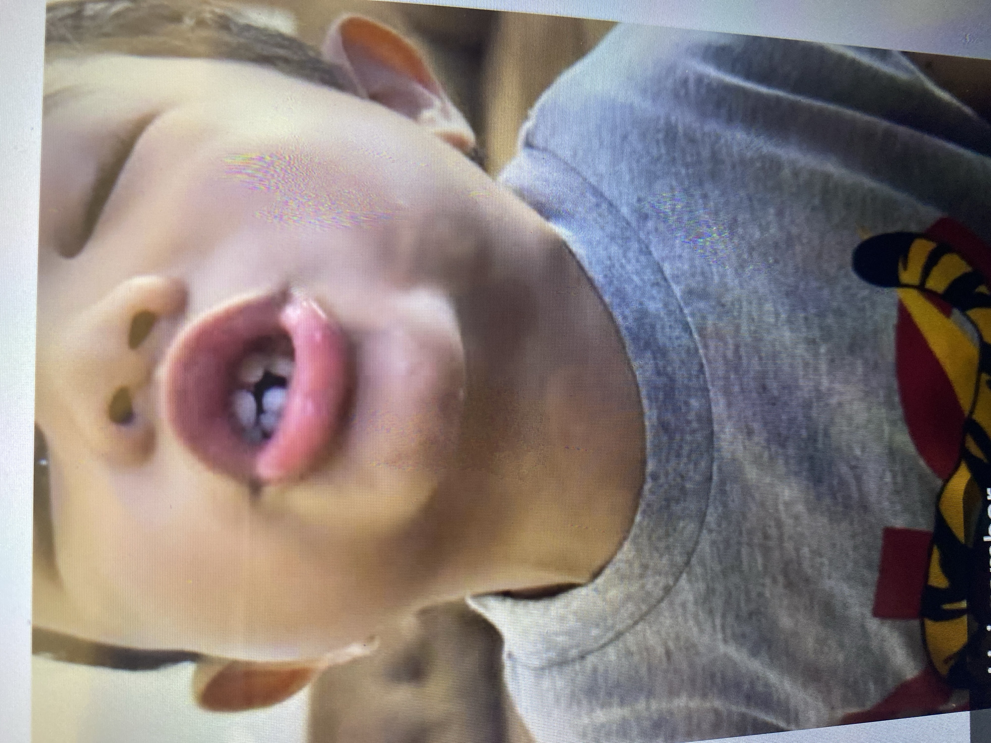 The image is a close-up, head-and-shoulders shot of a young child. The child's mouth is open, showing visible teeth and some saliva. The child is wearing a light grey t-shirt. The background is blurred and appears to be indoors, possibly a living room with furniture, but there are no specific landmarks or details that would allow for determining a location within Ta', Indonesia, or any other city. The image quality is low, with visible pixelation and lens flare.