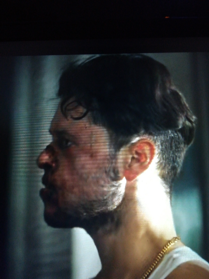 A man's profile shows evidence of a physical altercation. His face has abrasions and possible bruising. The hair is dark and thick on top with a very short, almost shaved, back and sides. He wears a white tank top and a thick gold chain around his neck. The background is blurred, suggesting a shallow depth of field, and a vertical textured pattern. Lighting from the front right of the image highlights the neck and ear.
