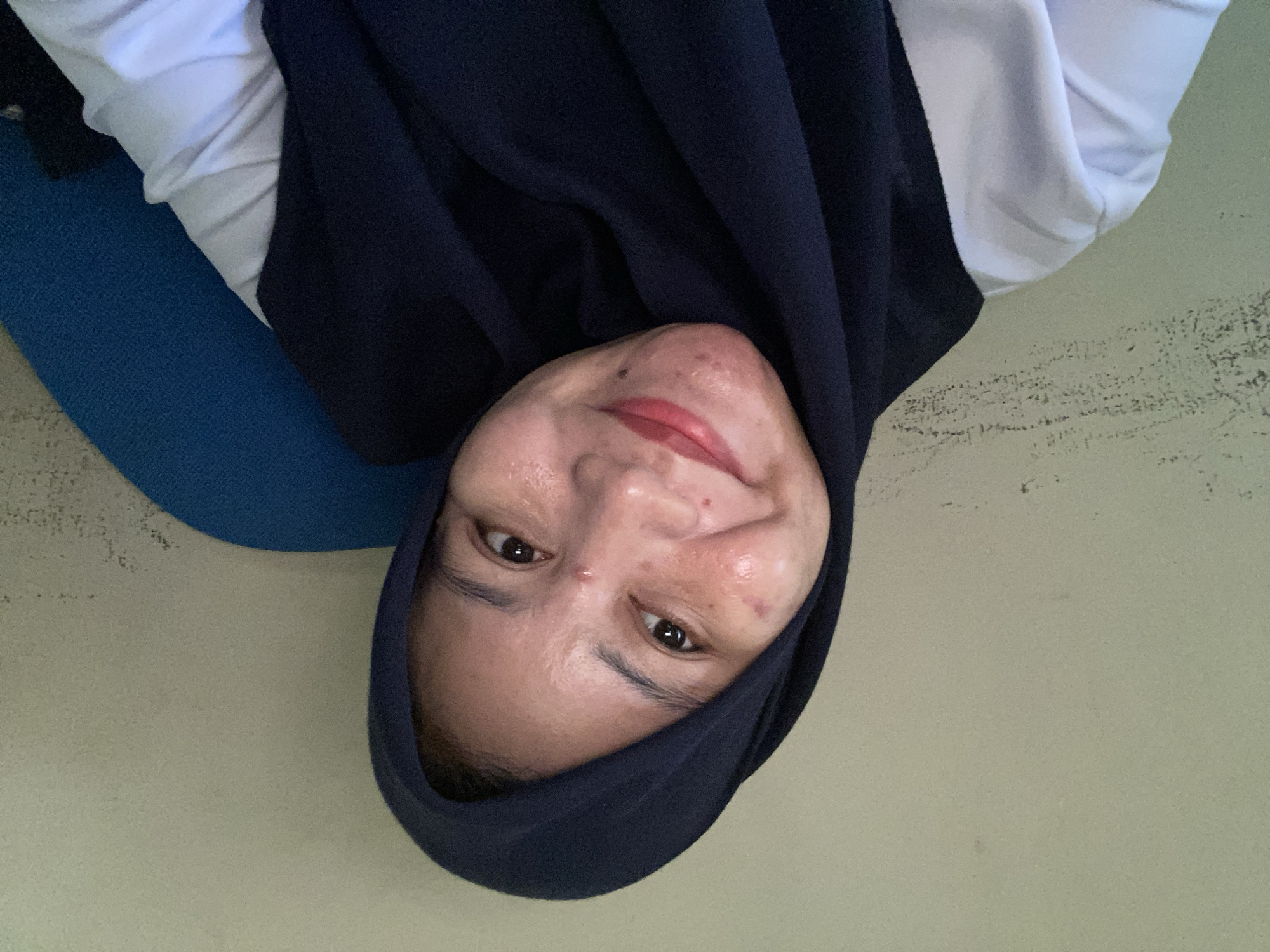A selfie is taken by a woman wearing a dark blue hijab and a white shirt. The woman is smiling and looking at the camera. Her face has several blemishes, including acne and some redness. The background appears to be a light-colored wall. The image seems to be taken indoors, possibly in a residential setting. It is not possible to determine the exact location within Banjarbaru, Indonesia, from the image alone.