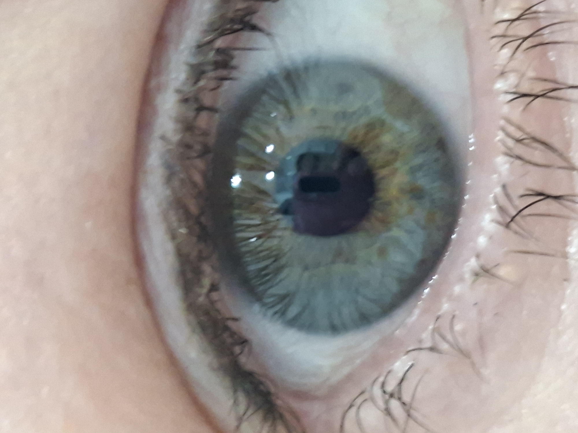The image shows a close-up of a human eye. The iris is a mixture of blue and green with flecks of brown. The pupil is dark. The surrounding skin is light-colored with visible pores and fine hairs. Eyelashes are present along the eyelid. The image is a photograph and does not depict any specific location in Izhevsk, Russia, or any identifiable actions or interactions.