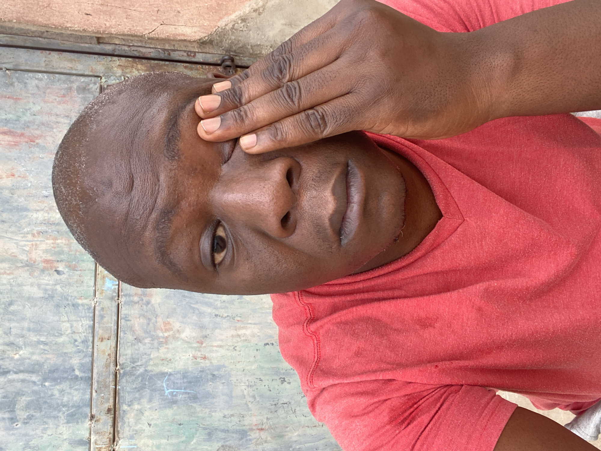 A close-up shot depicts a bald, dark-skinned man with a V-neck red shirt. His right hand is covering his left eye. The background consists of a wall with a weathered, metallic finish, suggesting an urban, possibly industrial setting. There is no verifiable information to place this image specifically in Sabon Tasha, Nigeria.
