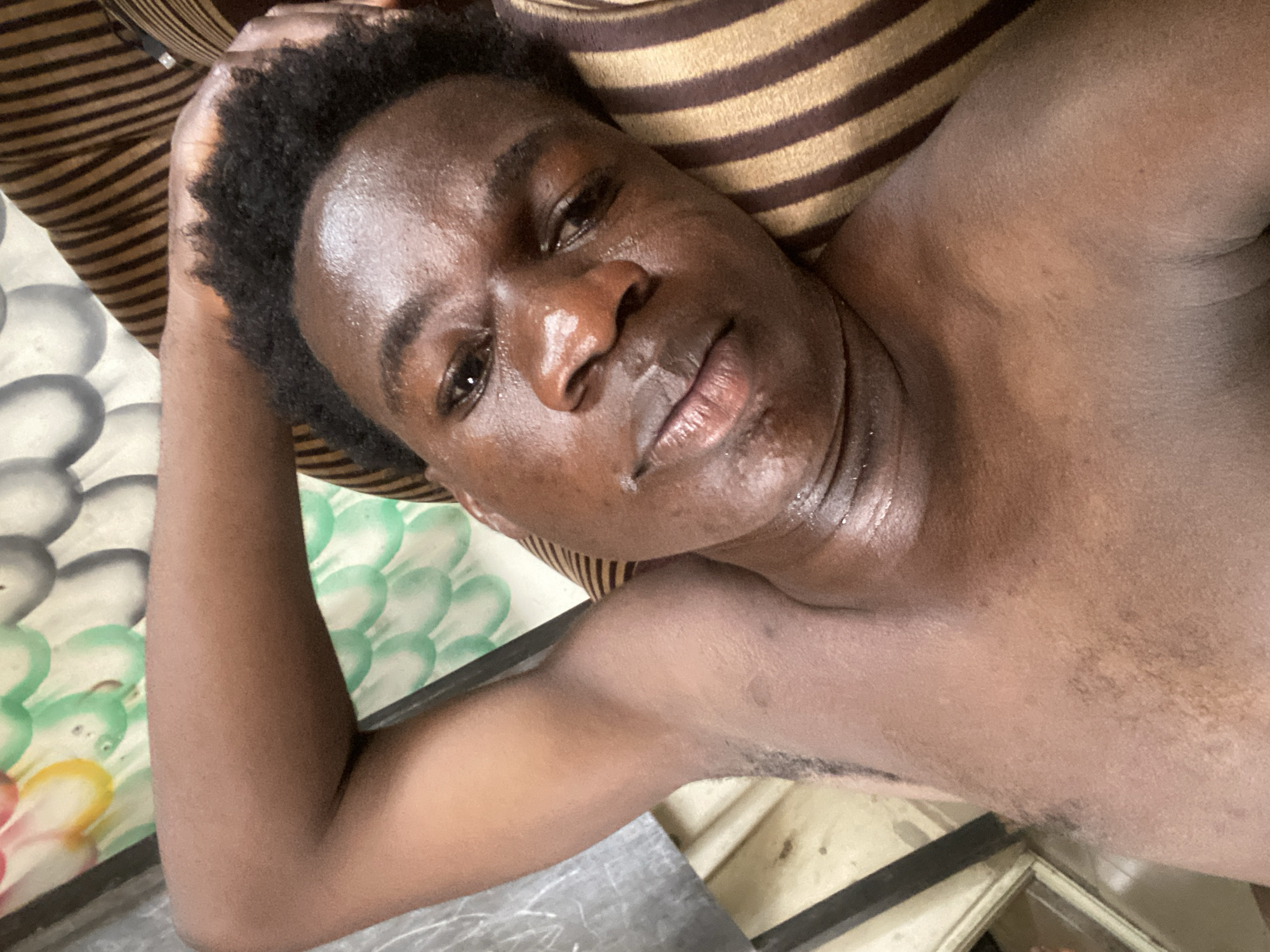 A young adult male is depicted in a close-up, high-angle shot, lying down indoors, likely in Mararaba, Nigeria. He is bare-chested, facing directly towards the camera, with his head resting on a surface characterized by broad horizontal stripes of brown and beige. His left arm is bent, with his hand positioned behind his head.
The subject has a dark complexion and short, dark, curly hair. His face and upper torso appear glistening, suggesting perspiration or oily skin, possibly due to warmth. He maintains a neutral expression, looking straight at the viewer. Details such as his eyebrows, nose, and lips are clearly visible.
To the left side of the frame, beneath his arm, a different patterned surface is visible, possibly a bedsheet or mattress cover, featuring abstract circular or scale-like designs in green, white, and hints of yellow. A dark, thin linear structure, resembling a frame or edge of furniture, is present in the lower left and right corners. The ambient lighting suggests it is daytime. There is no visible text in the image.