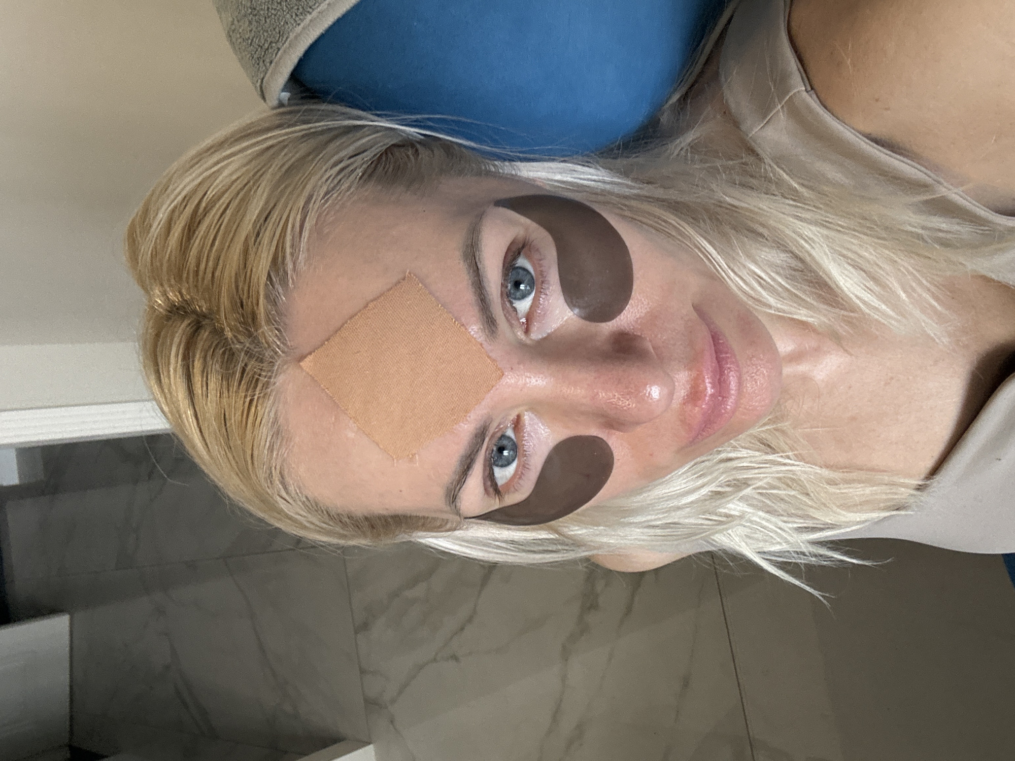 A woman with light blonde hair, blue eyes, and fair skin is lying down, looking up at the camera. She has brown eye patches under each eye and a square bandage on her forehead. The background appears to be a bathroom with marble-like tiles.