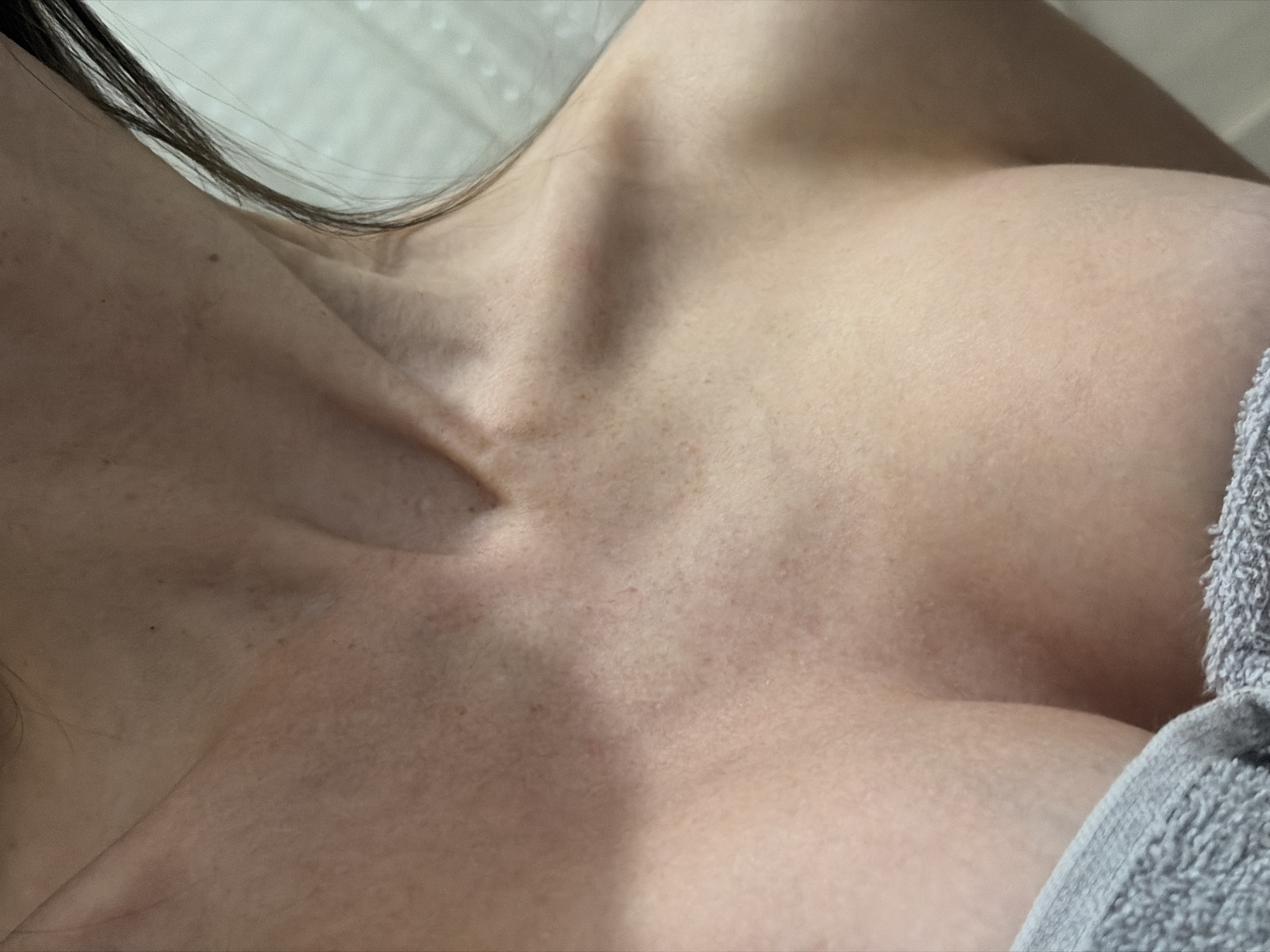 A close-up image captures a person's upper chest, neck, and shoulder area from a slightly elevated perspective. Long, dark hair falls over the left side of the frame, partially covering the shoulder. The prominent clavicle is visible, casting subtle shadows and highlighting the contours of the skin. The person's skin is light-toned, with visible freckles and moles scattered across the chest and neck. On the right edge of the image, a section of textured, grey fabric, possibly a towel or soft garment, is present. The background is softly blurred, suggesting an indoor setting. There is no specific activity depicted, and the focus is on the human form and skin texture under soft, diffused lighting. No text is visible.
