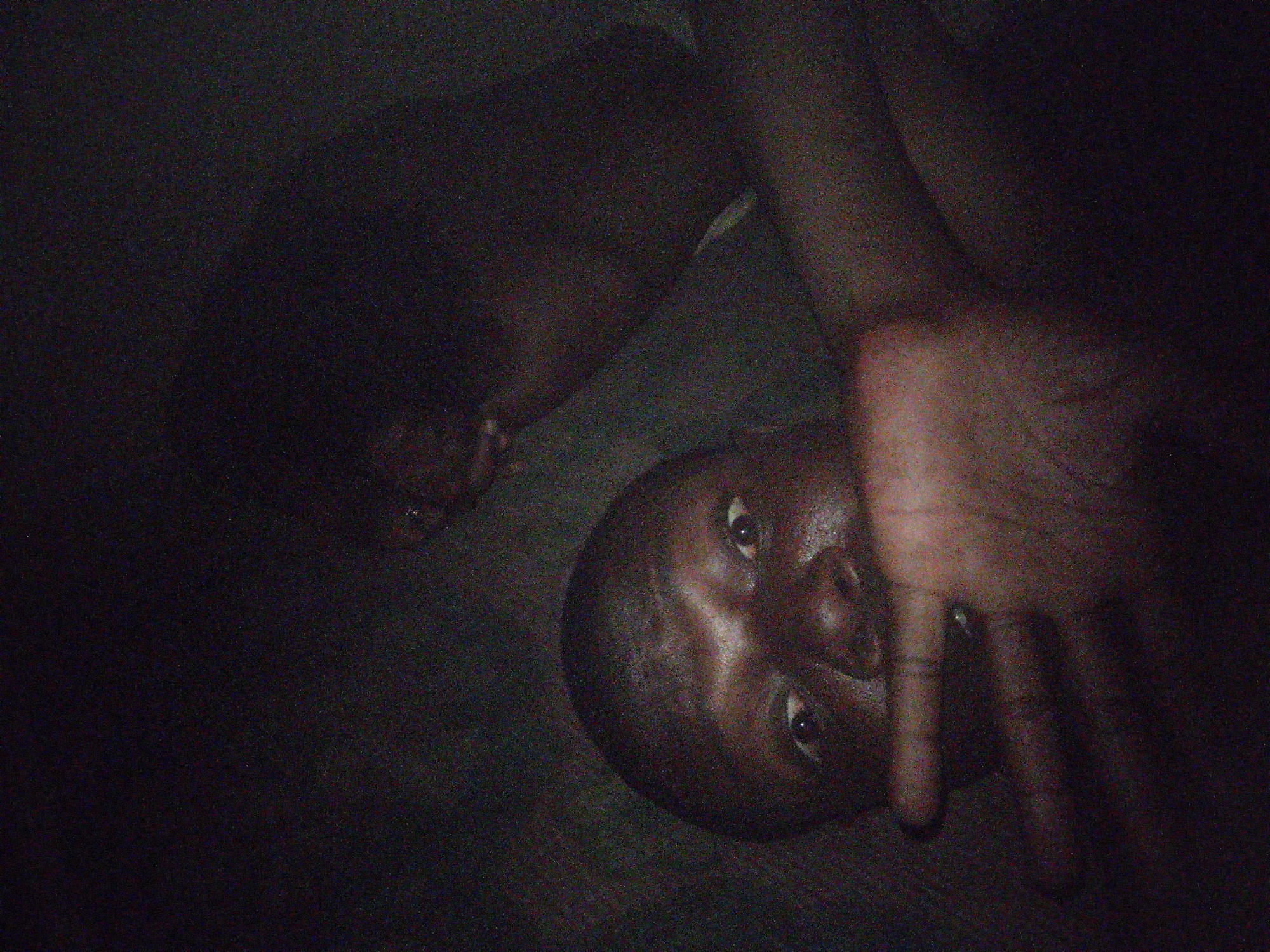 A close-up, dimly lit image features an individual, possibly male, facing the camera with his head angled. The face is shiny, and a hand is partially visible in the foreground. The background is dark and indistinct. The location is unidentified.