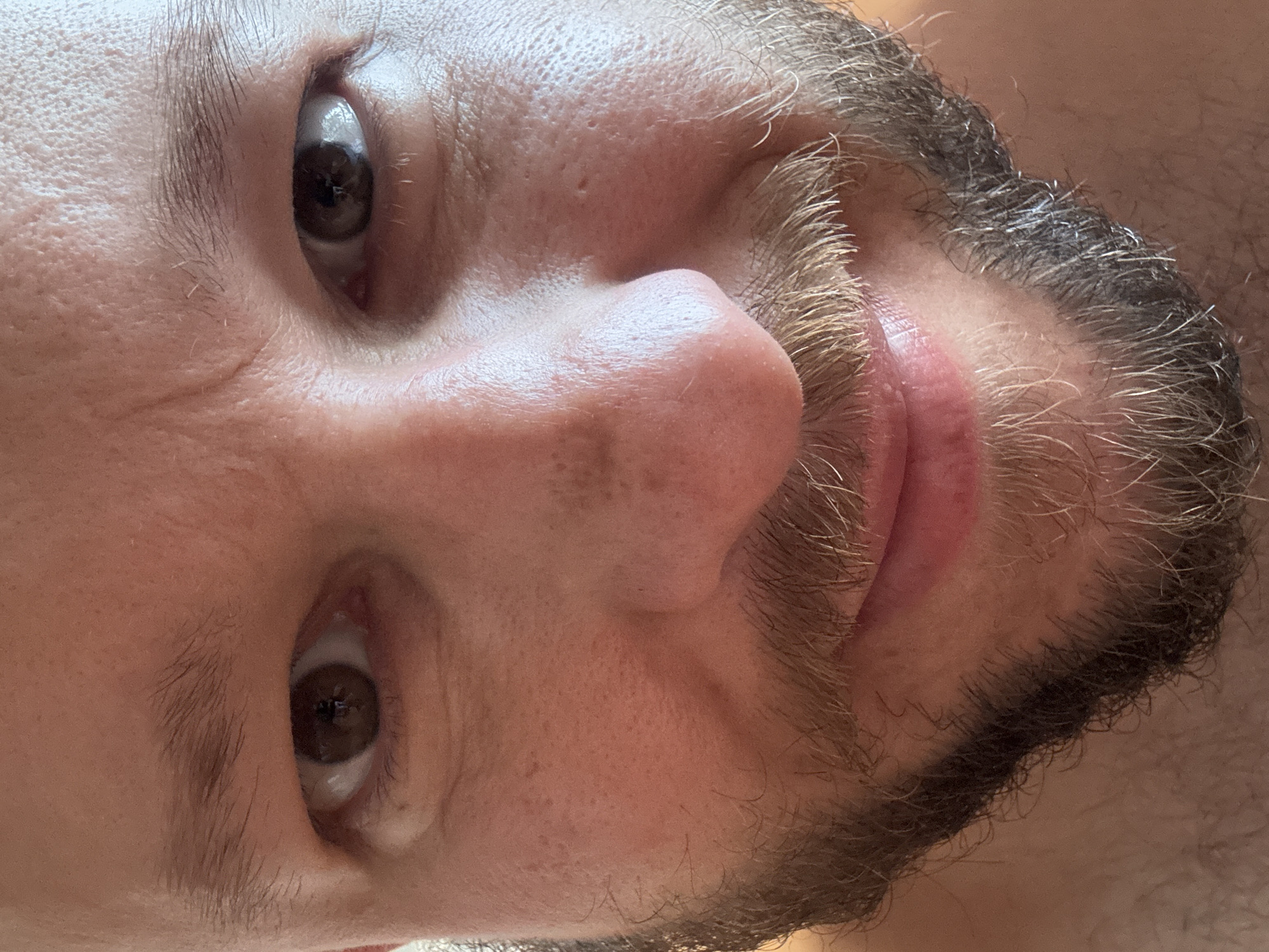 A close-up, head-on, selfie-style photograph of a man's face, from the eyes down to just below the chin. The man has brown eyes, fair skin with visible pores and some light blemishes, and a short, patchy beard and mustache. His eyebrows are also light brown and somewhat sparse. The lighting appears to be natural daylight, possibly from a window, casting soft shadows and highlighting the texture of his skin. The background is out of focus and appears to be a plain, light-colored surface, suggesting an indoor setting. There is no identifiable information about the location in Blagoveshchensk, Russia, within the image itself.