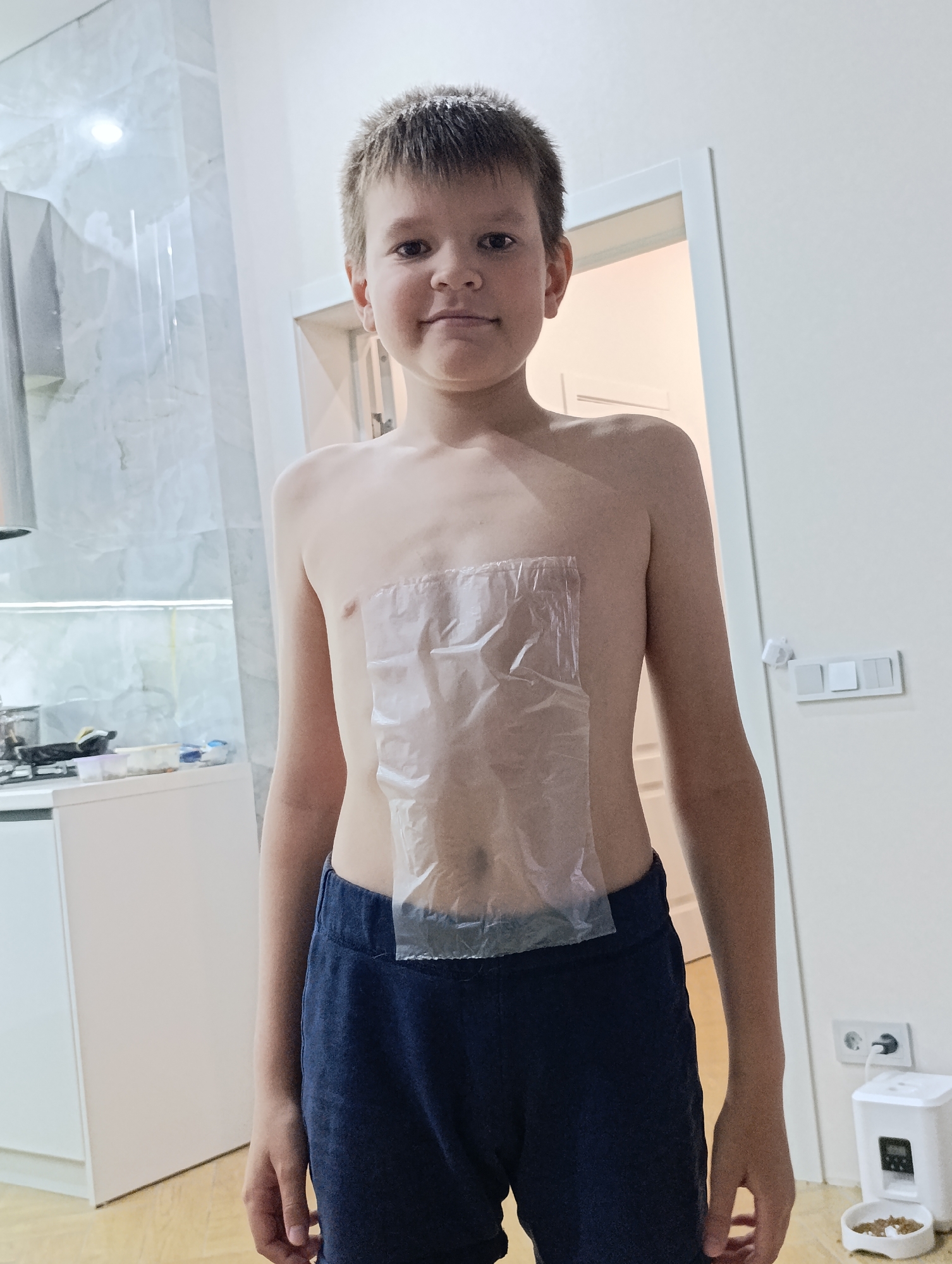 A young boy stands in a brightly lit room, facing the camera. He is shirtless and wearing dark blue sweatpants. A clear plastic dressing is taped to his chest. The boy has short, light brown hair and a neutral expression.
The setting appears to be a home interior, possibly a kitchen or dining area. In the background to the left, there is a white cabinet and a section of a kitchen counter with some items on it, including what looks like a stovetop and some containers. To the right of the boy, there is a white doorway and a wall with light switches and a white automatic pet feeder with a bowl of food in front of it. The flooring is light-colored wood.
The overall impression is that of a casual, indoor moment. There is no visible text in the image.