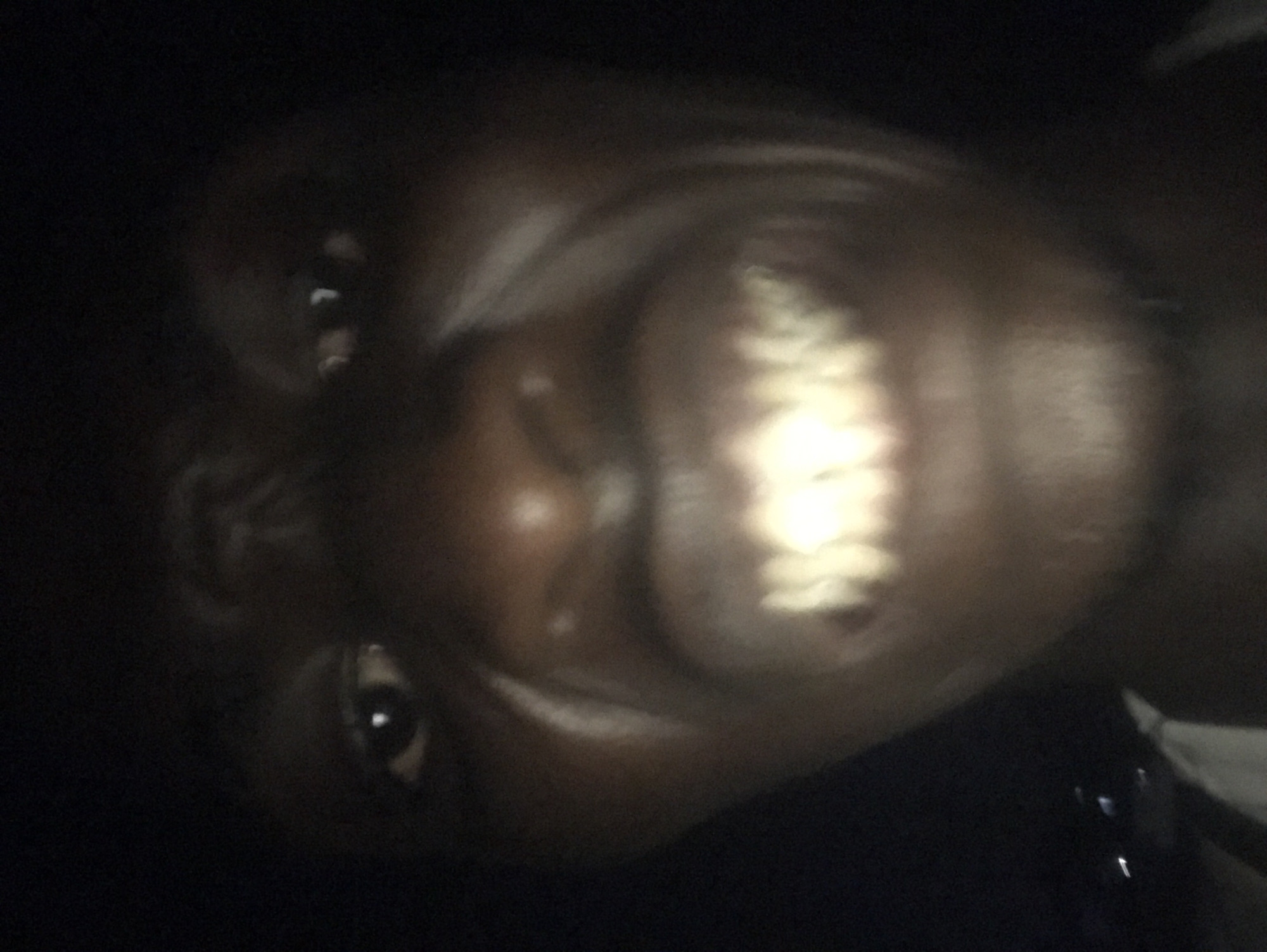 The image displays a close-up, rotated view of a person's face captured in extremely dim lighting. The individual has dark skin and is looking directly at the camera with their mouth open in a wide smile or laugh. Both eyes are visible, reflecting a faint light source. The most prominent feature is the intense, bright, almost metallic reflection emanating from the person's upper teeth, strongly suggesting they are wearing dental grillz. The face is rotated approximately 90 degrees clockwise. The background is completely dark and indistinct, offering no information about the setting. No specific activity beyond smiling is discernible. The overall impression is of a spontaneous moment in very low light conditions, possibly at night or in a dark indoor environment. No text is visible.