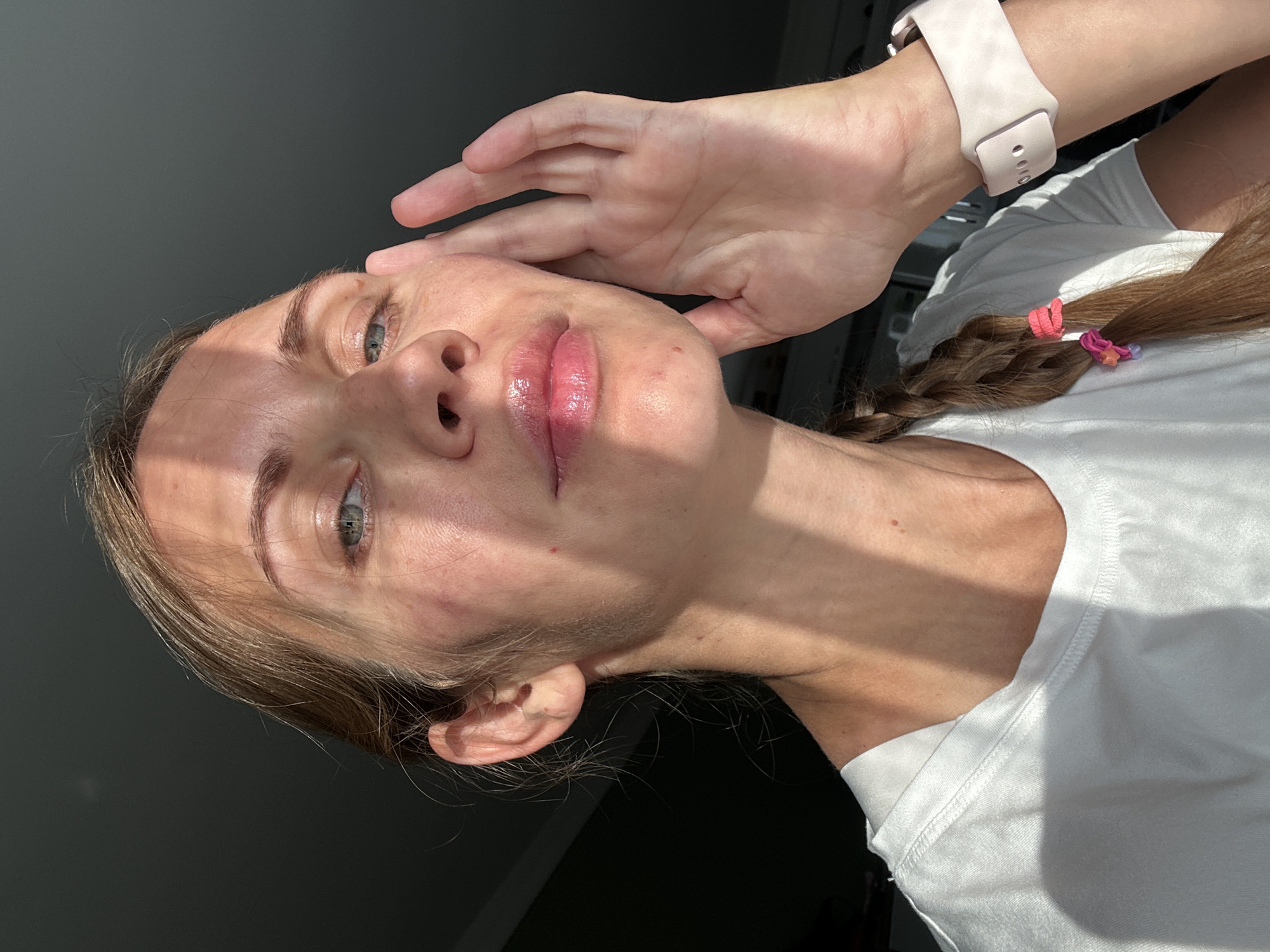 This image depicts a fair-skinned adult female, appearing to be in her 20s or 30s, positioned indoors in the city of Fethiye, Turkey. She is shown from the chest up, looking directly towards the viewer with a neutral expression. Her hair is light brown or blonde, styled in a long braid on her right side, adorned with small pink, orange, and purple hair ties. She is wearing a plain white, short-sleeved t-shirt. A light-colored smartwatch with a silicone strap is visible on her left wrist.
Her left hand is raised, with fingers gently splayed, touching the left side of her face and jawline. Her lips are full and appear glossy with a light pink tint. Visible skin features include small moles or imperfections on her cheeks and chin, and some redness or discoloration on both cheeks. Her eyes are light blue or green.
The scene is illuminated by strong, directional light originating from the upper right, casting distinct shadows across her face, neck, and the front of her t-shirt. Parts of her face, particularly her forehead, nose, and the right side of her face, exhibit strong light and shadow contrasts. The background is uniformly dark gray or black and out of focus, providing no additional environmental details.