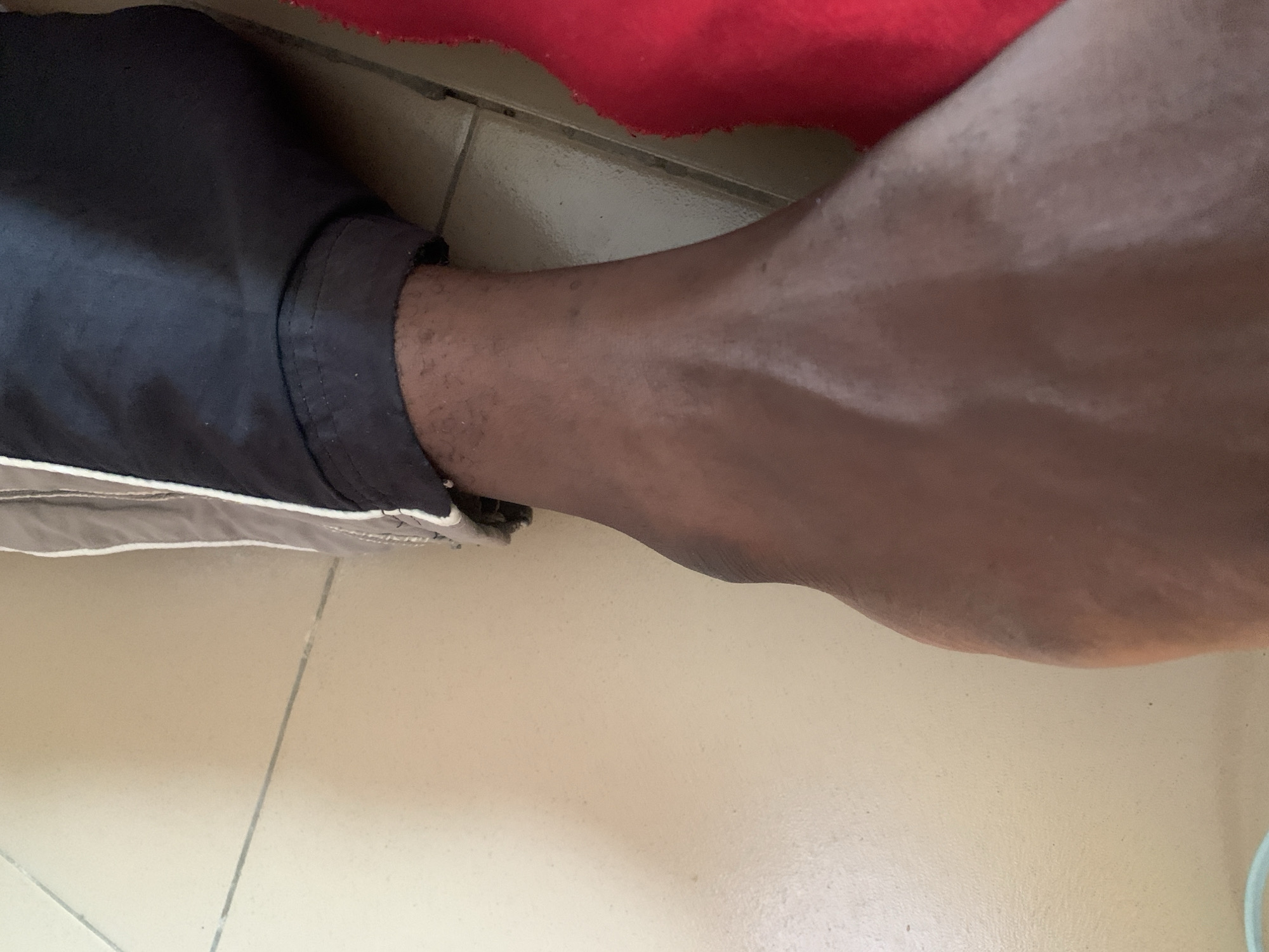 The image shows a close-up view of a person's lower leg and ankle, with part of their athletic pants visible. The skin tone is dark. The background consists of a light-colored tiled floor and a portion of a red fabric. The scene appears to be indoors. There are no discernible elements that would allow for the identification of a specific location within Jauro Yinu, Nigeria, as the image lacks any contextual landmarks, street signs, or architectural features indicative of that city.
