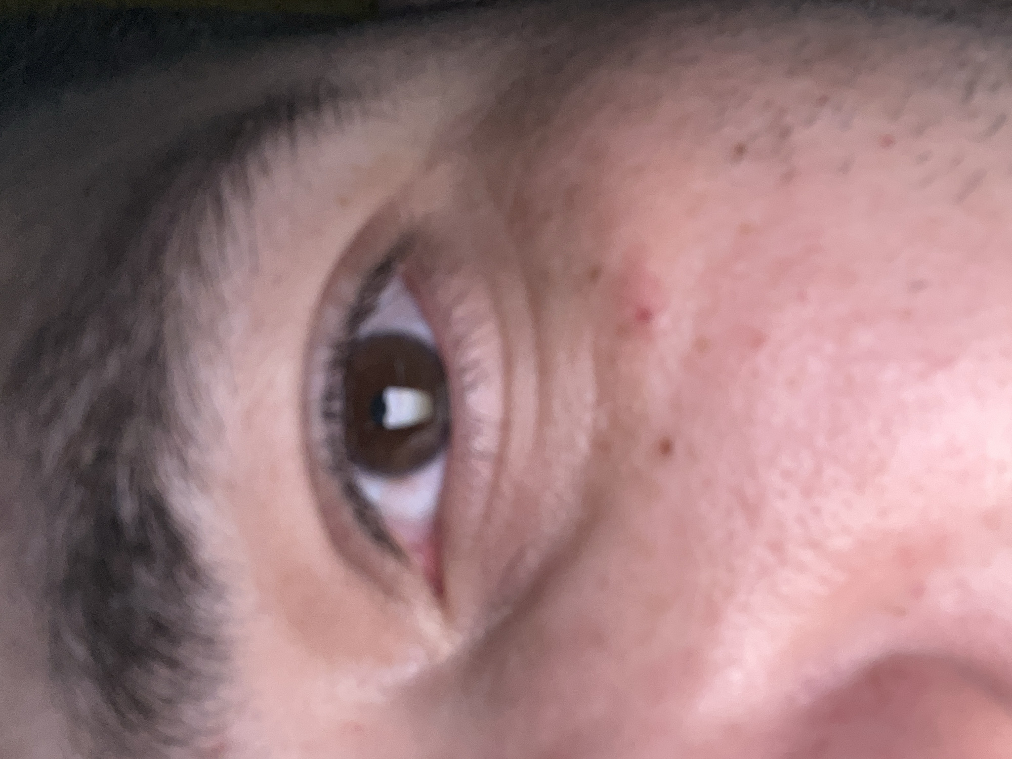 A close-up image shows a human eye with brown iris, surrounded by skin and eyebrow. The skin has visible wrinkles and a few small moles. The image provides no information related to the location of Chaikovsky, Russia.