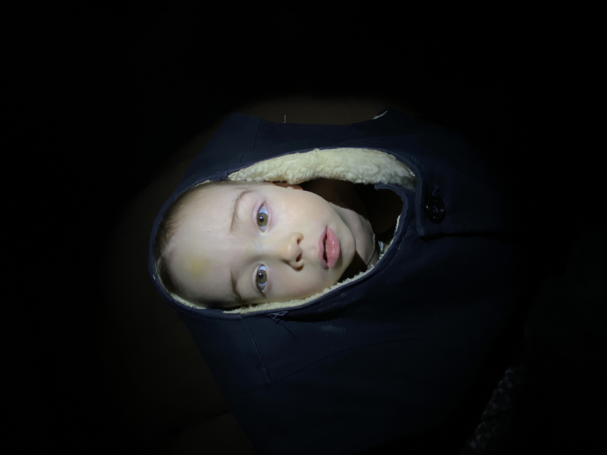 A close-up, low-angle shot depicts a young child's face emerging from a dark blue garment lined with light-colored, possibly shearling, material. The child has fair skin, light brown hair, and green eyes. A slight bruise is visible on the child's forehead. The garment has a button visible on its upper right side. The background is mostly dark and out of focus. The photograph was not taken in Ольховка, Russia; there is no information in the image to determine a location.