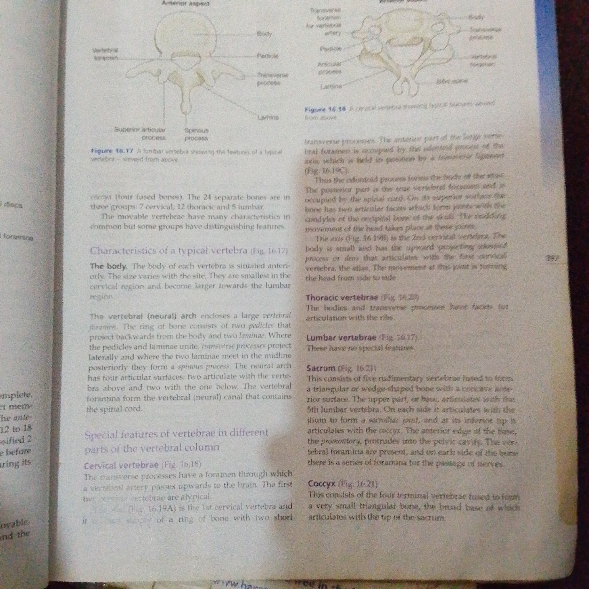 The image provided is a textbook illustration depicting the anatomy of the vertebral column. It shows diagrams of a lumbar vertebra (Figure 16.17) and a cervical vertebra (Figure 16.18) with various parts labeled, such as the body, pedicle, transverse process, spinous process, and vertebral foramen. The text accompanying the illustrations describes the characteristics of typical vertebrae, vertebral arches, and special features of cervical, thoracic, lumbar, sacrum, and coccyx vertebrae. There is no information present in the image that relates to the city of Jalingo, Nigeria, or any forensic scene.