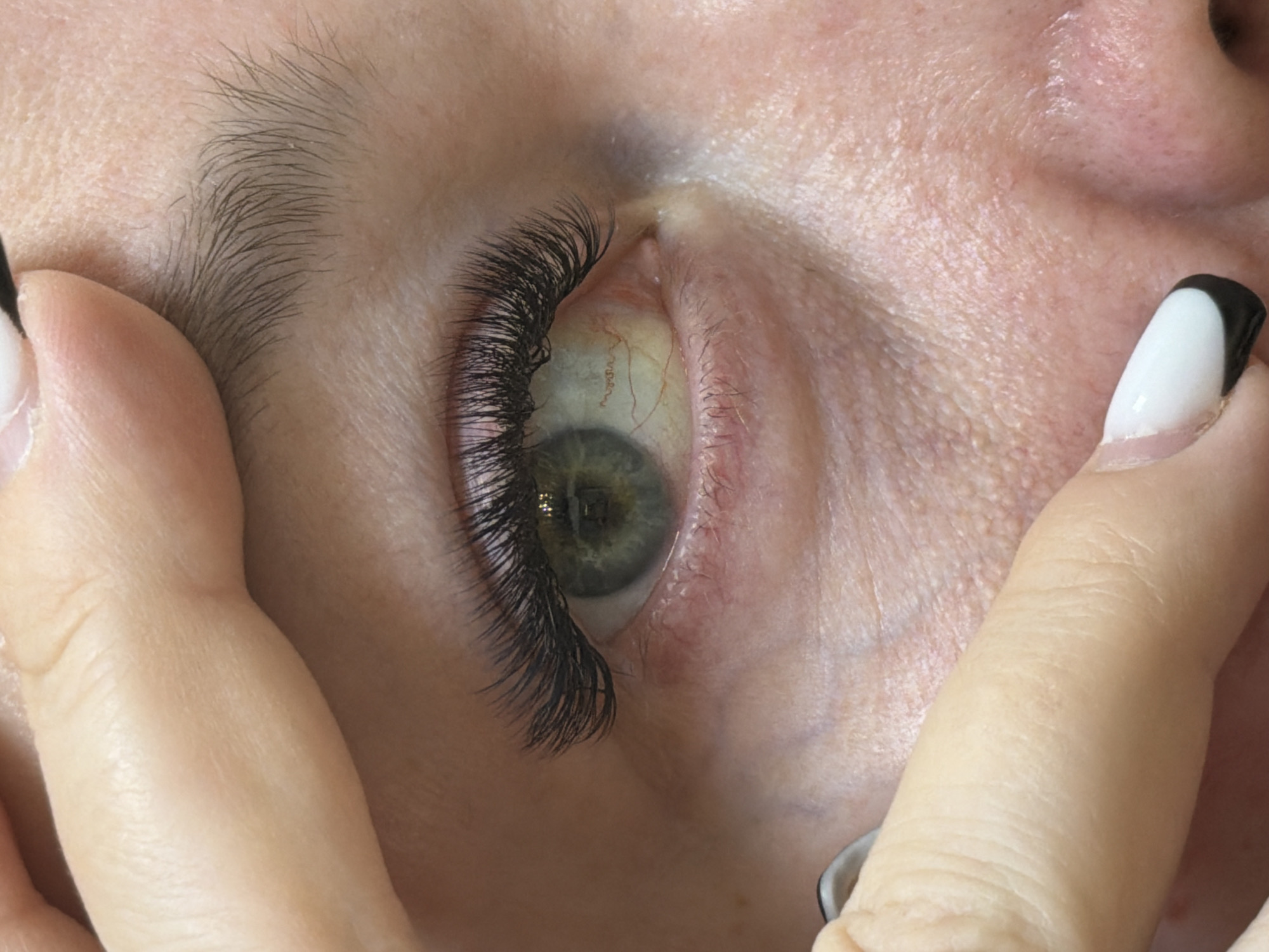 A close-up, high-resolution image captures a person's left eye, held open by two fingers. The subject has light-toned skin, displaying visible pores and fine lines.
The eye itself features a striking set of full, dark, and long eyelashes, indicative of eyelash extensions. The iris is a greenish-grey color, with a clearly visible, somewhat dilated pupil. The sclera (white part of the eye) exhibits a faint yellowish tint and prominent red blood vessels, suggesting some irritation or a subclinical condition like icterus. A natural, dark eyebrow arches above the eye.
Two fingers are positioned on either side of the eye, gently pulling the eyelids apart to expose the eyeball. The fingernails on these fingers are manicured with a distinct black and white French tip design. The lighting is bright, illuminating the intricate details of the skin, eye, and eyelashes. The context suggests an activity such as an eye examination, the application or maintenance of eyelash extensions, or a similar aesthetic procedure. No text is visible in the image. The image provides no specific time of day or weather cues.