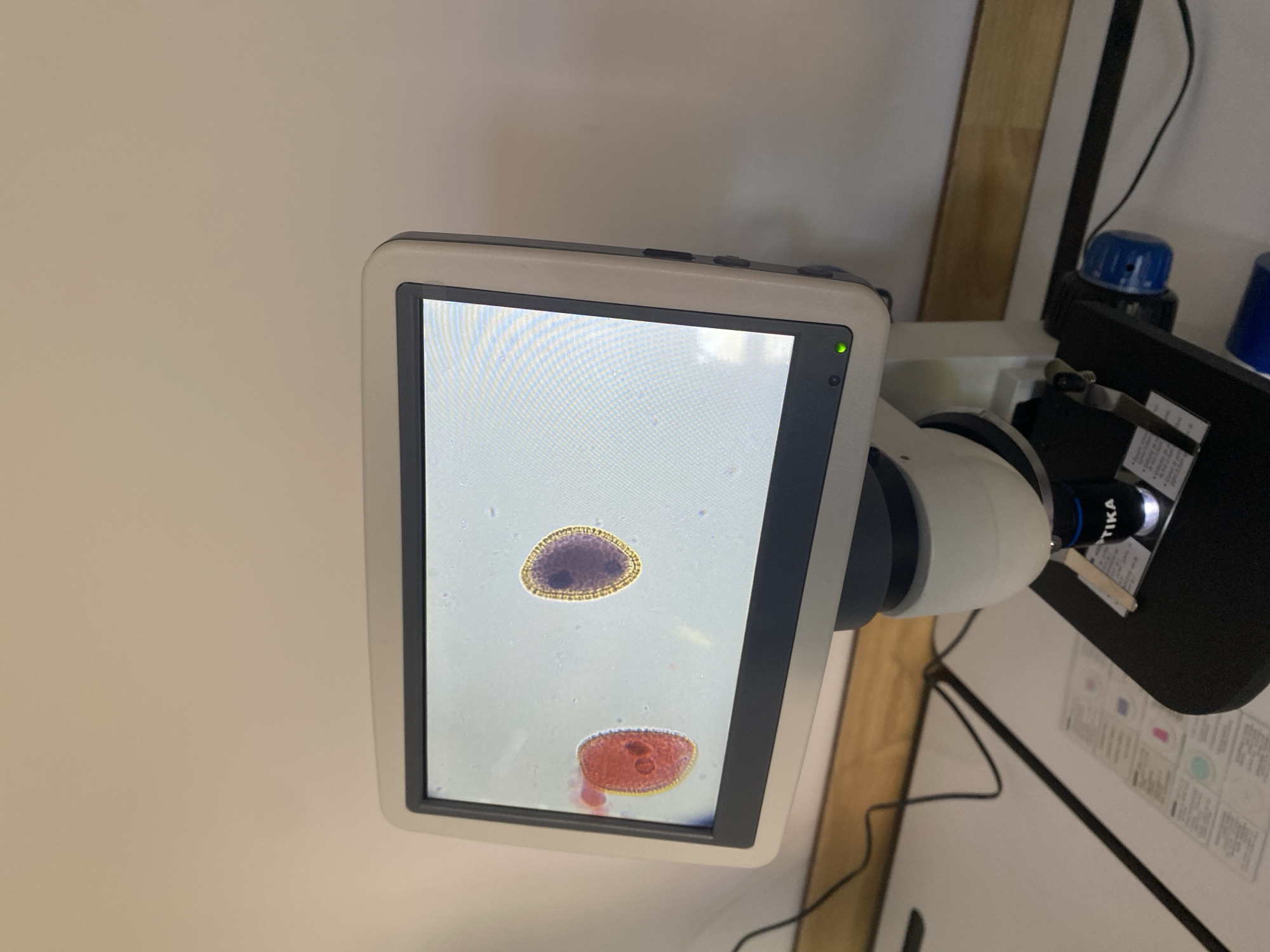 The image shows a digital microscope displaying two oval-shaped objects on a white background. The object on top appears dark purple, while the object on the bottom is red. The screen is attached to a microscope with blue and black components, and the brand "TIKA" is visible on one of the microscope parts. The background includes a white wall, a wooden beam, and electrical wires. There is no information in the image to determine the specific location in Burgas, Bulgaria.