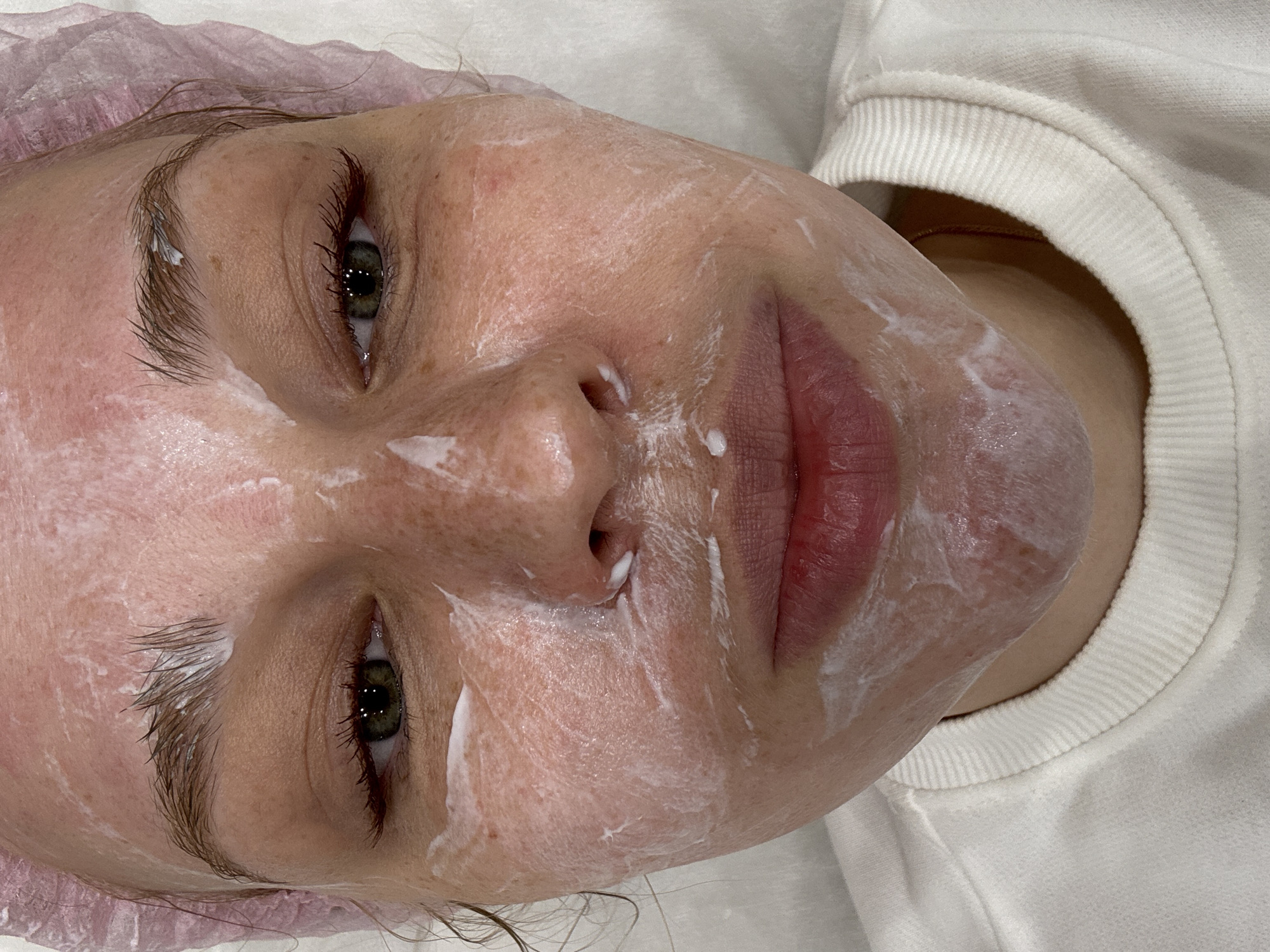 A woman lies face up, presumably on a treatment table, covered in a white cream or lotion, likely for a facial treatment. She wears a disposable surgical cap over her hair and a white sweatshirt. Her eyes are open, and her lips are slightly parted. The background consists of a white surface, suggesting a clinical or spa environment. There is no indication of the image location.