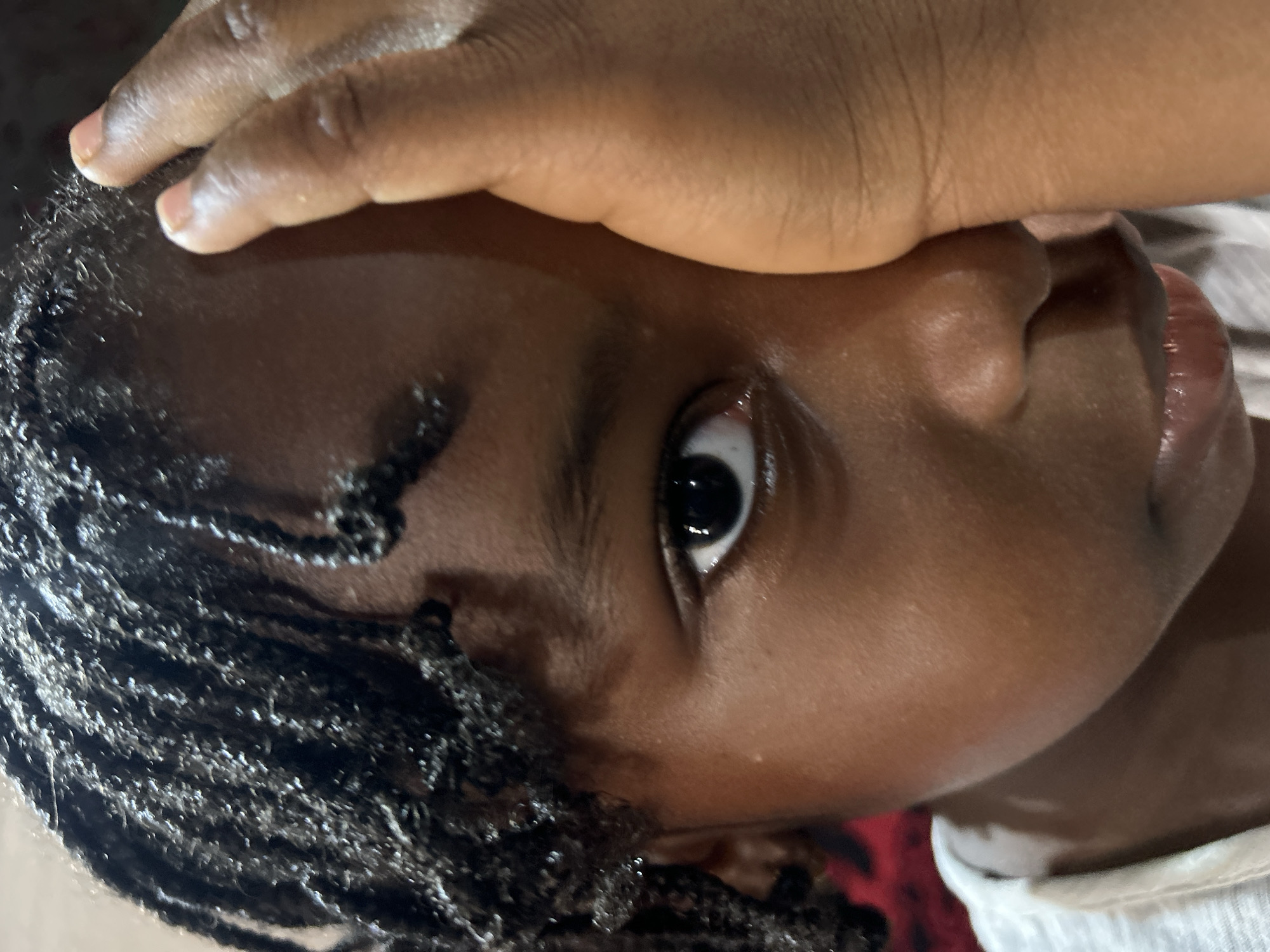 A close-up, slightly angled shot depicts a young person with dark skin and braided hair. A hand rests on their forehead, partially obscuring the hair. The person's right eye is prominent, dark, and glistening. The background is indistinct, appearing to include a light-colored garment and a possible red and black pattern. No specific elements identify the location as Jos, Nigeria. The subject is facing slightly away from the camera, revealing their cheek and lips.