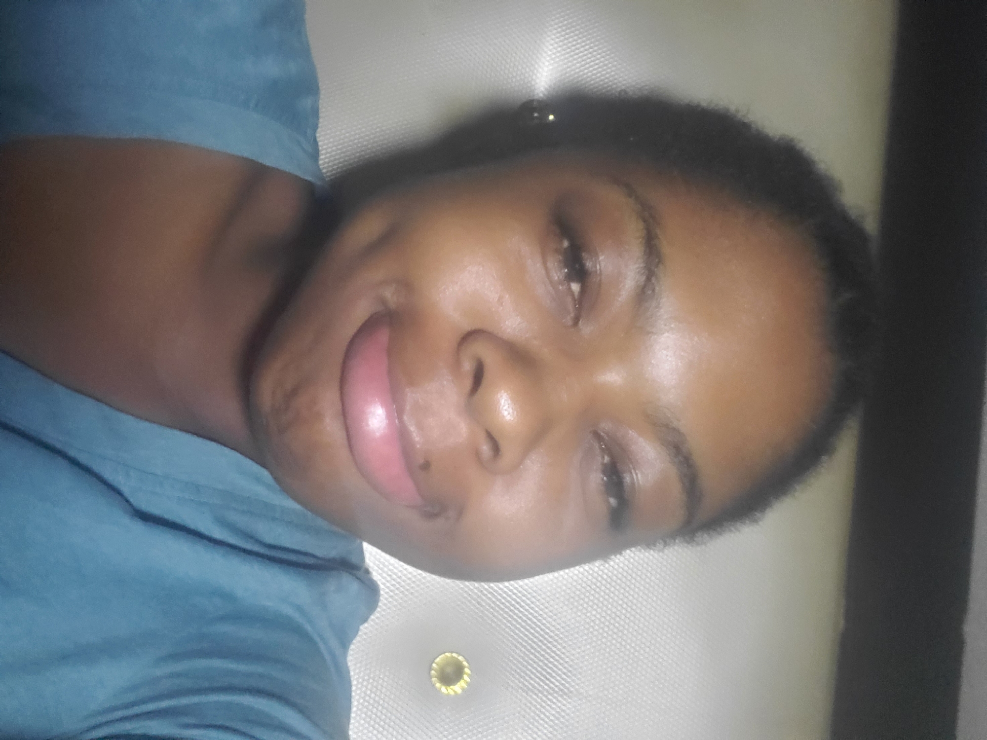 A close-up portrait features a Black woman facing the camera with a slight smile. Her lower lip appears significantly swollen and engorged. She wears a teal short-sleeved garment. A small, reflective stud earring is visible in her left ear. The background consists of a light-colored, textured, possibly padded wall surface with a repeating grid pattern. A circular, golden, decorative button or tack is present on the wall to the right of her face. The image provides no visual information to determine a specific geographic location.