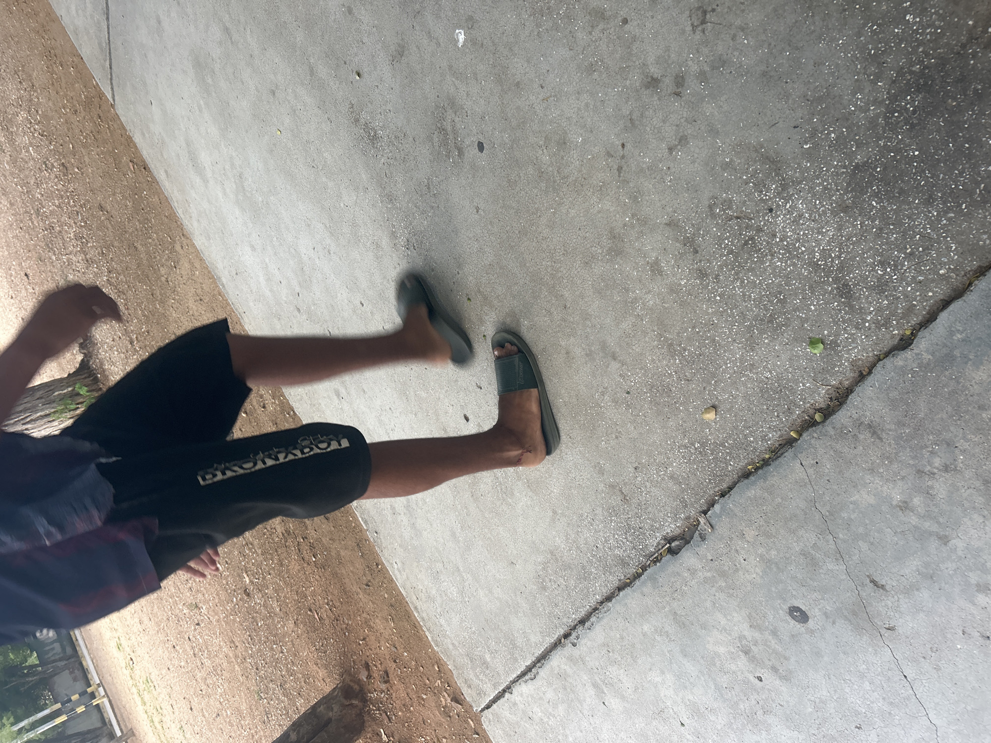 The image shows the lower body of a person walking on a concrete path. The person is wearing black shorts with white text on the left leg and dark colored slides on both feet. The environment appears to be outdoors, with a dirt path adjacent to the concrete. Trees are visible in the background. There are no discernible landmarks or features that specifically place the image in Santa Ana, Venezuela.