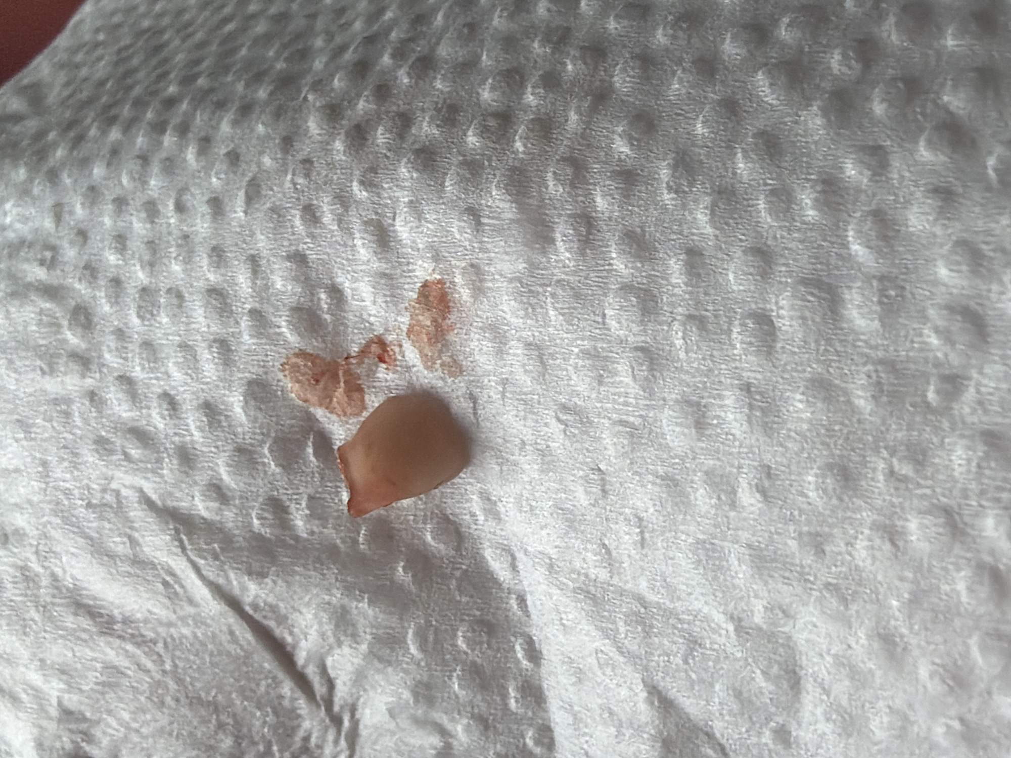 The media file displays a close-up, overhead shot of a crumpled white paper towel with a few small, discolored specks and a single, light brown, oval-shaped object on its surface. The paper towel has a textured pattern of small indentations. The specks appear to be reddish-brown in color, suggesting they might be dried blood or some other substance. The larger oval object is smooth and slightly translucent, with a more solid appearance. The lighting suggests it is indoors, likely in natural daylight given the soft illumination. There are no visible people, specific settings, or text. The context provided is "Chaikovsky, Russia," but there are no visual cues in the image to confirm or deny this location. The image focuses on the textures and colors of the paper towel and the small items on it, creating a somewhat sterile and abstract composition.