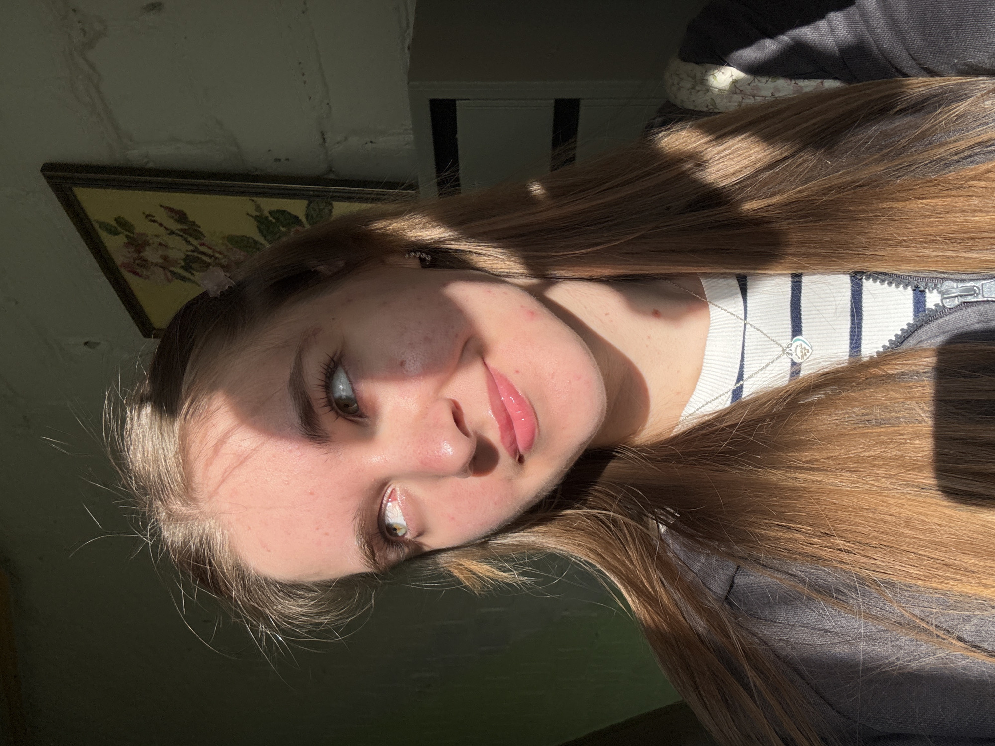 The image shows a young woman with light brown hair, light skin, and visible blemishes on her face. She is wearing a striped top, a gray jacket, and a silver necklace with a heart-shaped pendant. The background includes a textured wall, a framed picture with floral motifs, and an area that appears to be outside. There is strong sunlight creating sharp shadows on the woman's face and hair. It is not possible to determine the exact location in the city of Perm, Russia, based on this single image.
