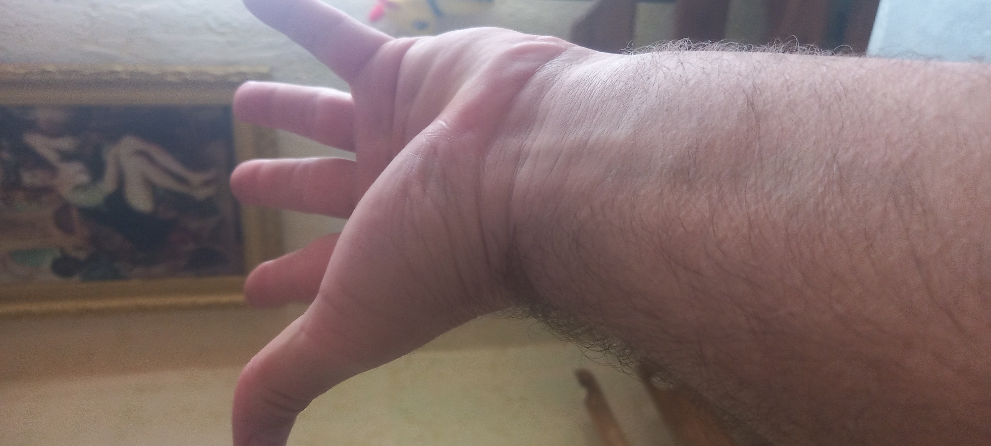 The image shows a close-up of a person's hand and forearm, with the palm facing away from the viewer. The arm is light-skinned with visible hair. In the background, a framed picture hangs on a wall, depicting figures in a blurred, indistinct scene. The location is likely indoors, given the presence of furniture and the picture on the wall. No information is provided to ascertain this image was taken in Kryvyi Rih, Ukraine.