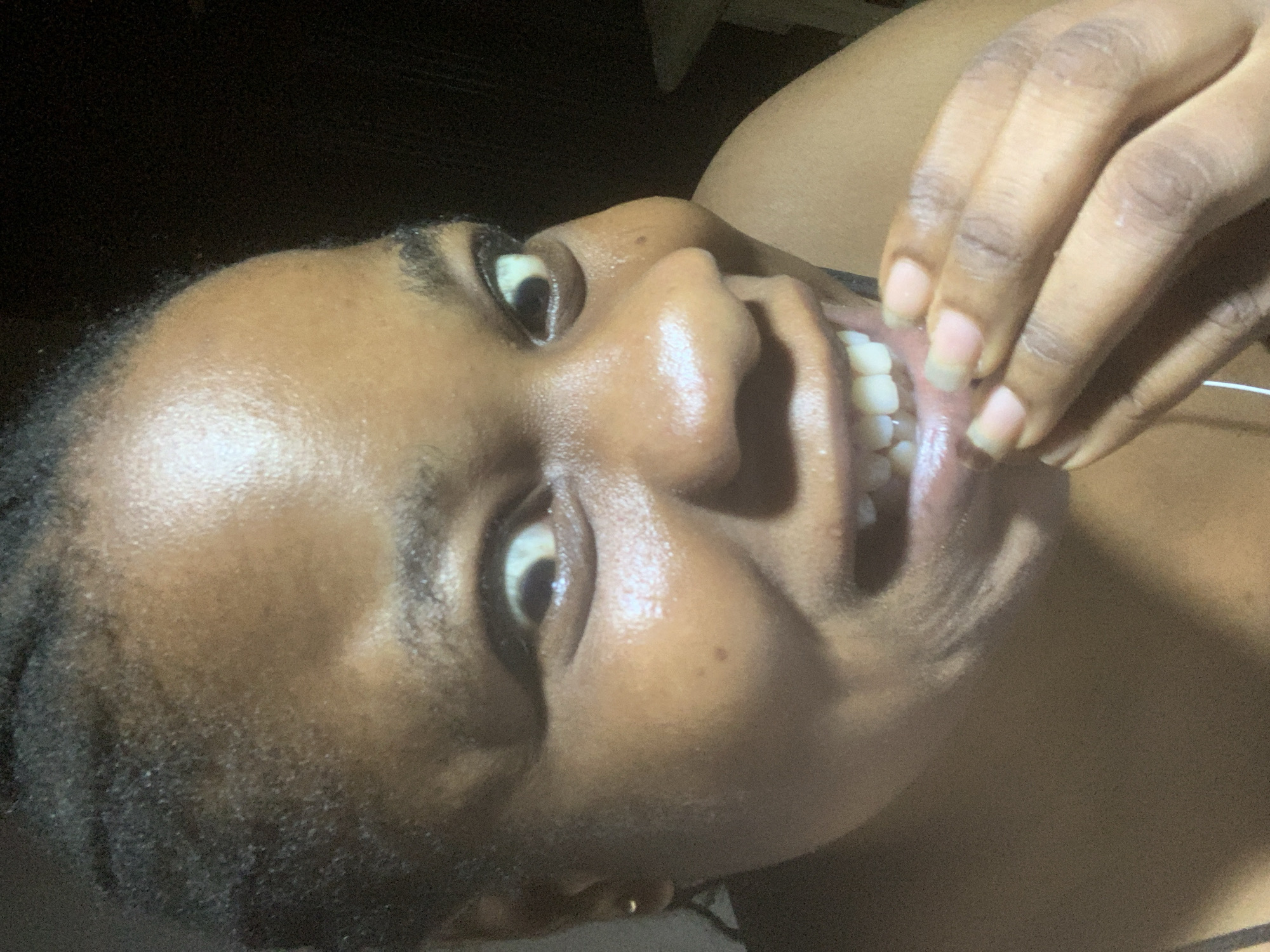 A close-up, low-angle shot captures a person with dark skin looking up at the camera. The person is holding their lower lip open with their fingers, revealing their teeth. The skin appears shiny, possibly due to lighting or perspiration. The background is dark and out of focus. There are no visible indications of a city or specific location.
