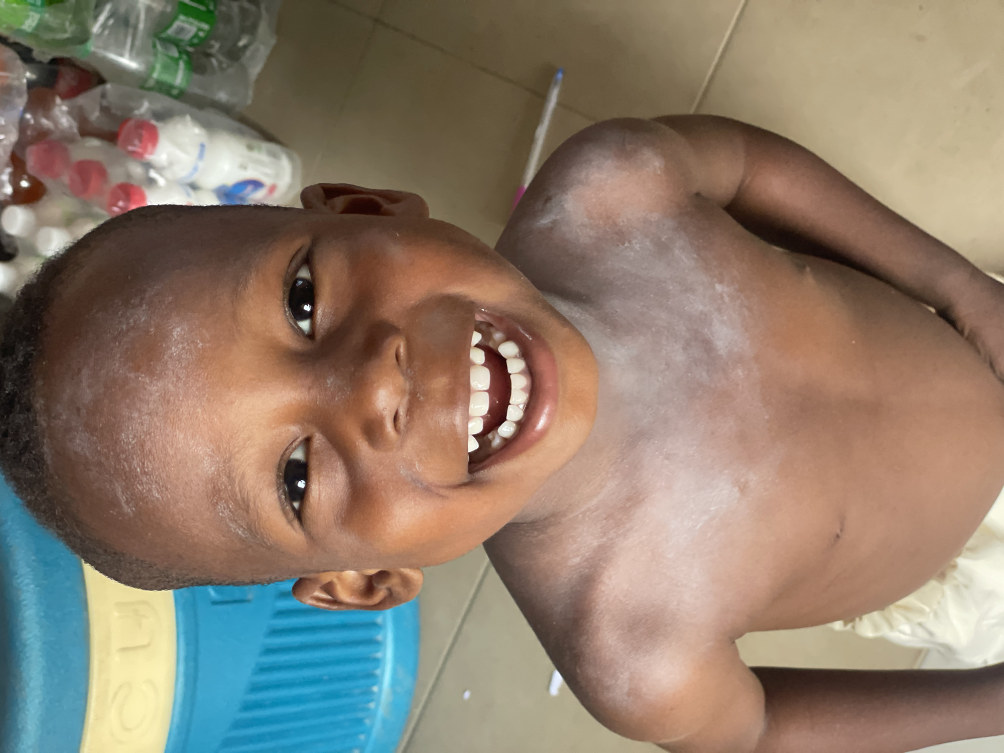 A close-up portrait shows a young, dark-skinned child, likely a boy, smiling broadly and looking directly into the camera. He has short, dark hair and a wide, joyful expression, revealing a full set of healthy white teeth. The child is shirtless, with a light-colored garment visible around his waist.
A prominent white powdery substance, possibly baby powder, is dusted across his chest, shoulders, and forehead, creating a noticeable contrast against his skin. A small, dark mark is visible on his right arm or torso.
The background suggests an indoor setting, possibly a home or a small shop in Lokoja, Nigeria. To the child's left, a vibrant blue and yellow container or cooler is partially visible, with faint characters resembling "C 3" on its yellow section. Behind and to the child's right, several clear plastic bottles, some filled with liquid, are stored in plastic bags, appearing as stacked items or merchandise. The floor is made of light-colored tiles. The scene is brightly lit, indicating daytime. The child's overall demeanor conveys happiness and playfulness.