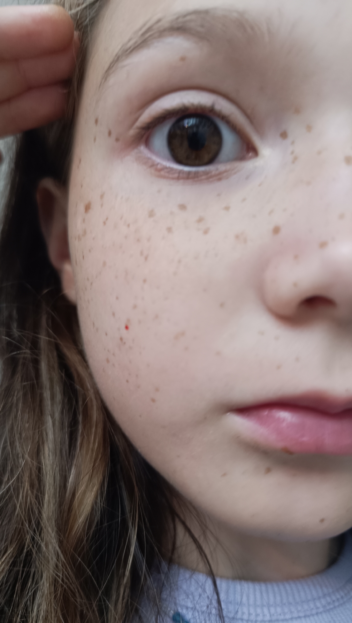 The image is a close-up, low-angle, blurry, and overexposed portrait of a young girl's face. The focus is on her right eye, which is large and brown with a dilated pupil, and her freckled cheek. A small red mark is visible on her cheek. Her mouth is slightly open, revealing a hint of teeth. Her hair, which appears brown and slightly messy, frames her face. She is wearing a light blue sweater. The background is out of focus, but appears to be indoors. The image does not contain any information about its location in Chaikovsky, Russia, or any other specific geographic details.