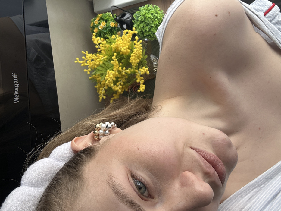 In Kar'yer, Russia, a female subject with fair skin, light brown hair, and blue-green eyes is depicted from the mid-chest upwards, facing the camera with a subtle smile. She wears a white, braided headband and a cluster-style ear cuff on her left ear, composed of white, gold-toned, and silver-toned spherical elements. Her left shoulder is bare, and a white, possibly striped, garment is visible on her chest. A reddish mark is present on her left clavicle/shoulder area. The background behind her head is a dark, reflective surface bearing the visible text "Weissgauff." To her right and behind her shoulder, a wooden surface supports a clear glass vase holding yellow artificial flowers, two small spherical green artificial plants, and a small black teapot.