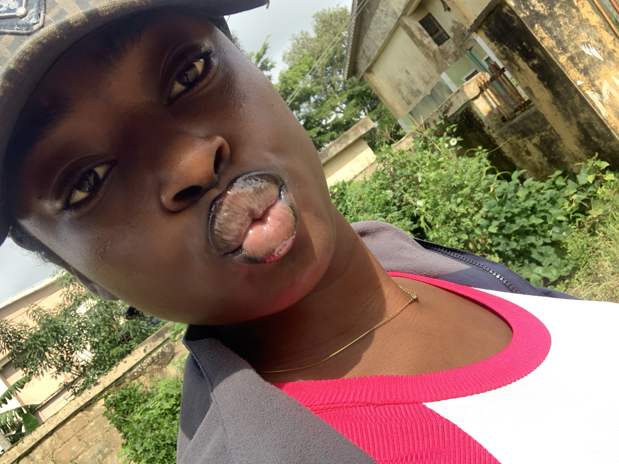 The image is a close-up, tilted selfie of a person's face and upper torso, taken outdoors during the day. The subject, who appears to be wearing a camouflage patterned hat and a grey zip-up jacket over a white tank top with a pink trim, is looking directly at the camera with full, glossy lips. Their eyes are partially visible, and they are wearing a thin gold chain necklace.
The background suggests an urban or semi-urban environment, likely in Rafin Par, Nigeria. Green foliage, including trees and bushes, is visible, indicating a possibly residential or overgrown area. Behind the greenery, there are buildings with muted yellow and light green exteriors, some appearing aged with visible discoloration and weathered textures. A section of a brick wall is also present. The lighting indicates it is daytime, with the sun casting shadows and highlighting facial features. The overall composition and focus are centered on the subject's face, with the background slightly out of focus.