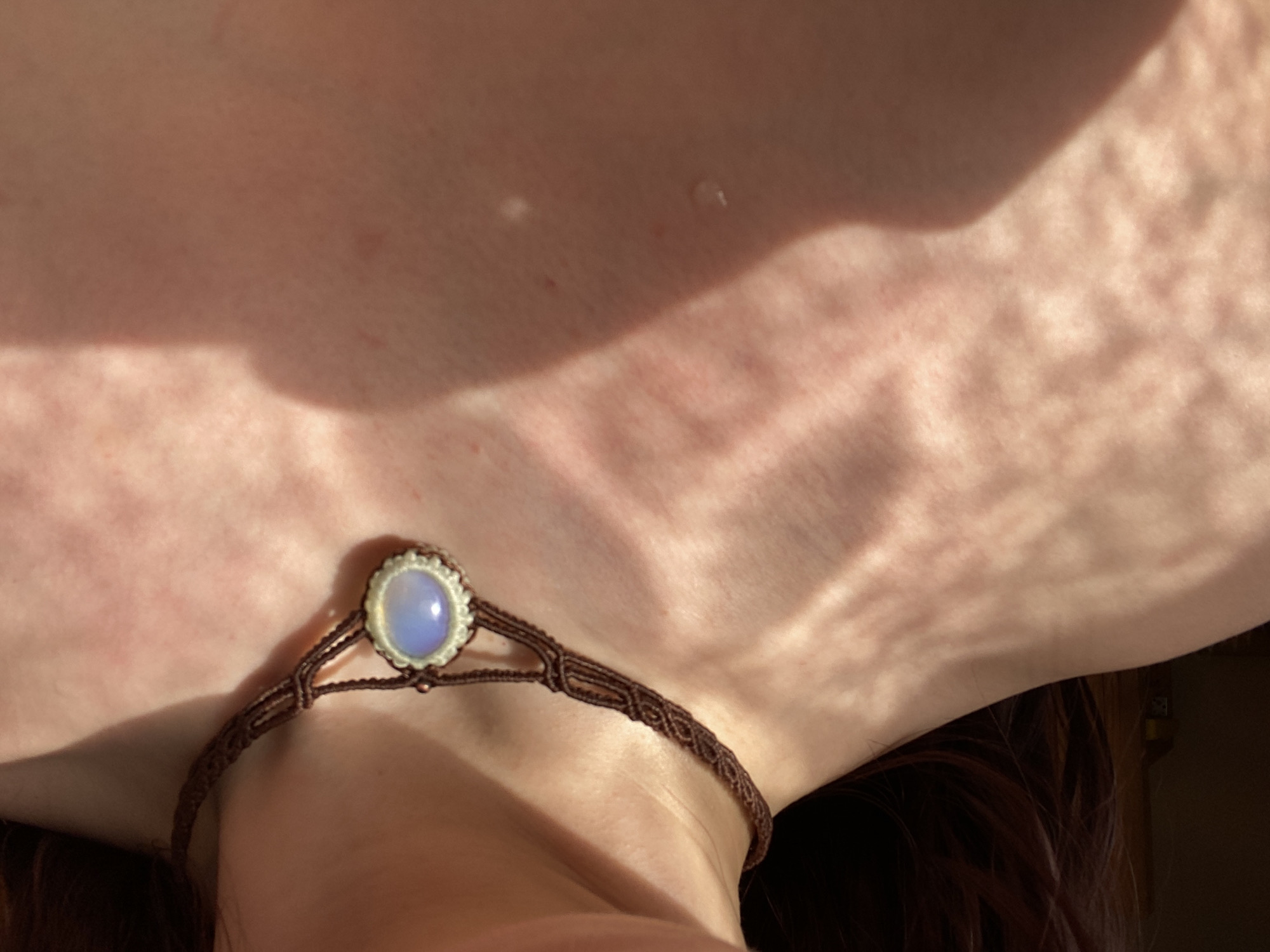 A close-up shot features a person wearing a brown macrame necklace with a round, light-blue stone pendant. The necklace encircles their neck. The skin visible around the necklace appears fair, with some reddening and textures. Sunlight or strong light is casting shadows across the skin. Parts of the person's red hair are visible in the bottom corner. The location in the city of Фоки, Russia cannot be determined from the visual information provided.