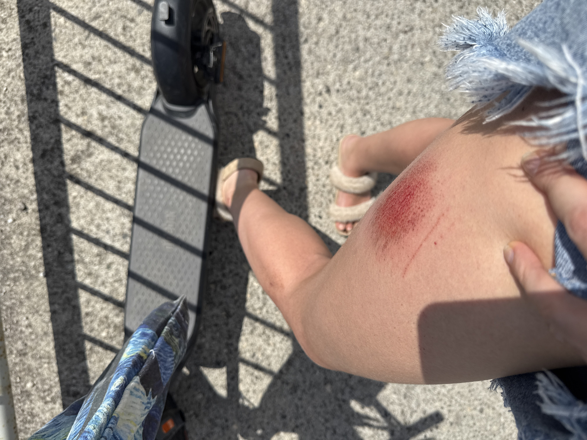 A first-person perspective image shows a person's leg with a scraped knee. The scraped area is red and appears to be a fresh wound. The person is wearing a denim skirt with frayed edges and fuzzy slippers. In the background, an electric scooter is visible, as well as a concrete surface with shadows cast by a fence. The environment appears to be outdoors, possibly in a park or on a sidewalk in Budva, Montenegro.