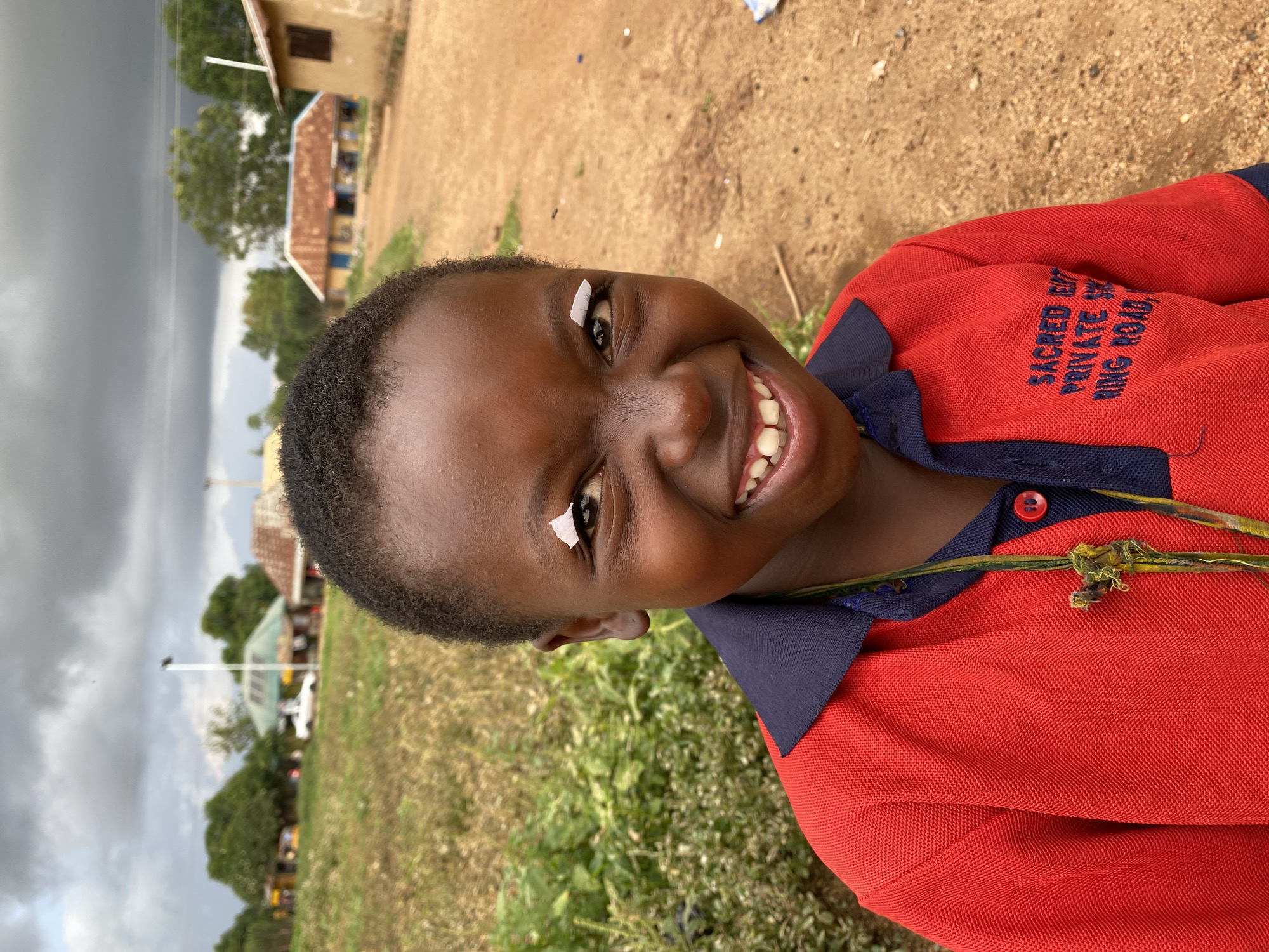 A young person with dark skin, identified by a red and navy polo shirt labeled "SACRED HEART PRIVATE SCHOOL, RING ROAD," smiles towards the camera with two pieces of white tape on their forehead and above their eye. The person is outdoors, possibly on a grassy field, with buildings and trees visible in the background under a cloudy sky. The location is near Ring Road in Vom, Nigeria based on the shirt label.