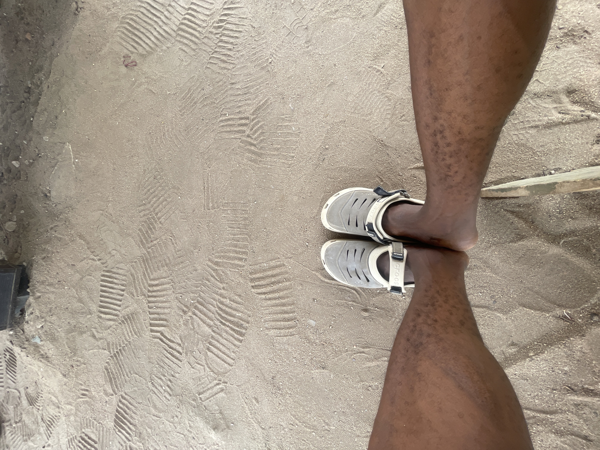 The image presents a top-down view of a person's lower legs and feet on sandy ground, characteristic of a riverbank or sandy area, likely in Lokoja, Nigeria. The individual has dark skin and is wearing light grey and white Crocs brand sandals, with the "Crocs" logo visible on the straps. Both feet are positioned side-by-side on the sand.
The sandy surface is covered with numerous distinct imprints from various footwear, featuring ridged and textured patterns, suggesting prior foot traffic. Small pebbles and scattered debris are also visible across the sand. A light-colored wooden stick or plank lies partially on the ground to the right of the person's right leg. The overall lighting indicates it is daytime. The perspective focuses closely on the feet and the immediate ground, capturing the details of the sand and the footwear.