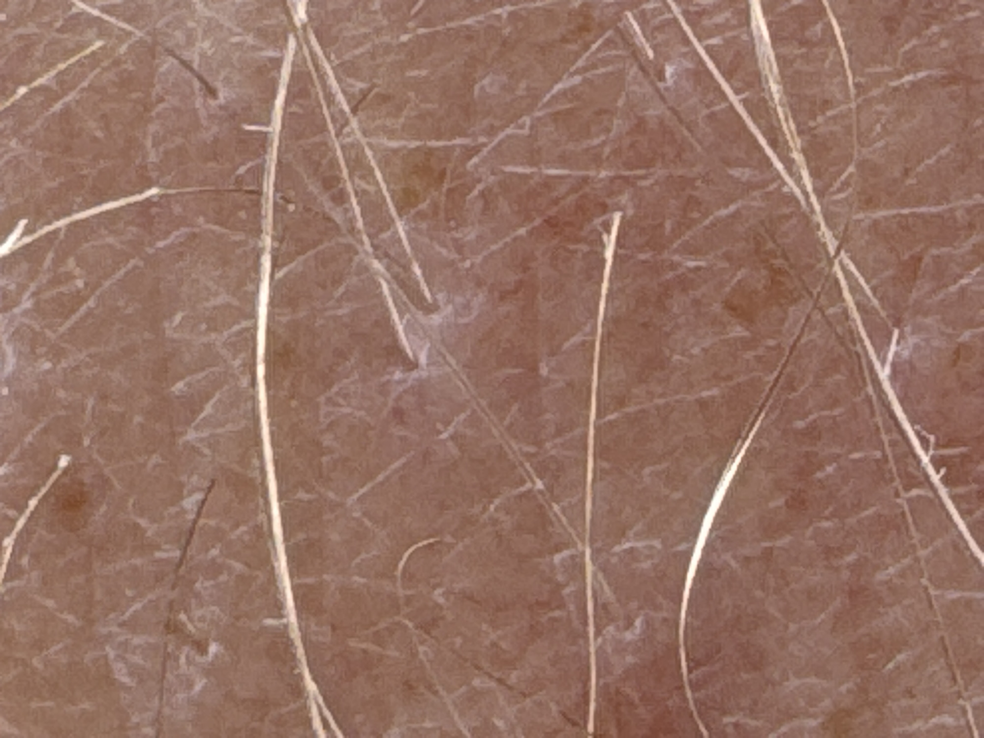 The image is a close-up, microscopic view of human skin. It shows a textured surface with visible pores and fine hairs. The skin appears to be light brown in color with a network of lines that could be skin creases or a result of the imaging process. Several fine, light-colored hairs are present, lying across the surface of the skin at various angles. There are also a few darker, thinner hairs. The overall impression is of a detailed examination of skin topography, likely from an epiluminescence microscopy or similar dermatological imaging technique. The image contains no information about the city of Strümpfelbrunn, Germany.