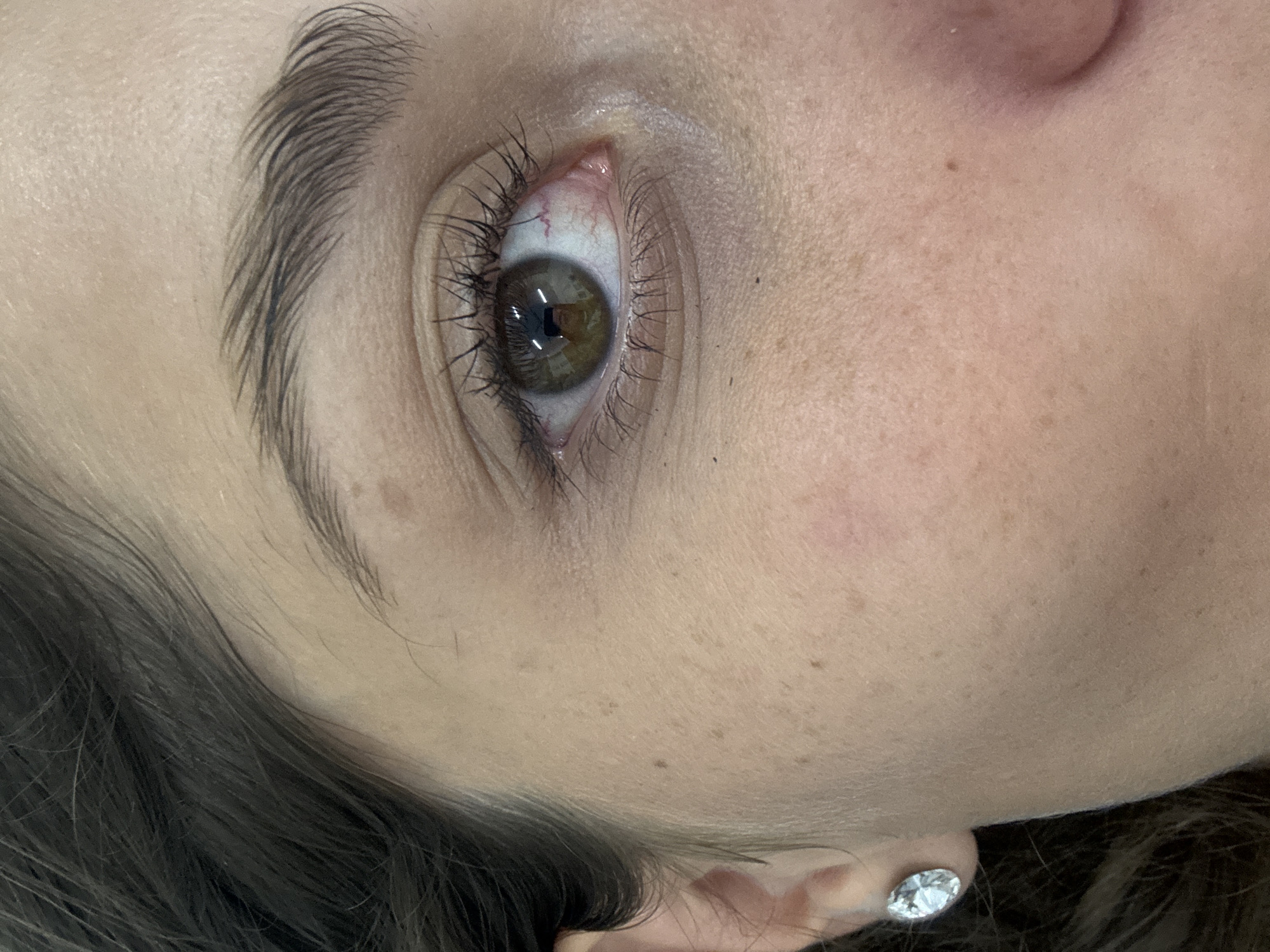 A close-up image focuses on a person's right eye and eyebrow. The eye is brown with visible eyelashes and some redness. The eyebrow is dark and thick. The person's skin tone is light, with some freckles or blemishes visible. An earring is present in the earlobe. The environment is unidentifiable. The location is unknown and cannot be inferred from the image. No actions or interactions are discernible.